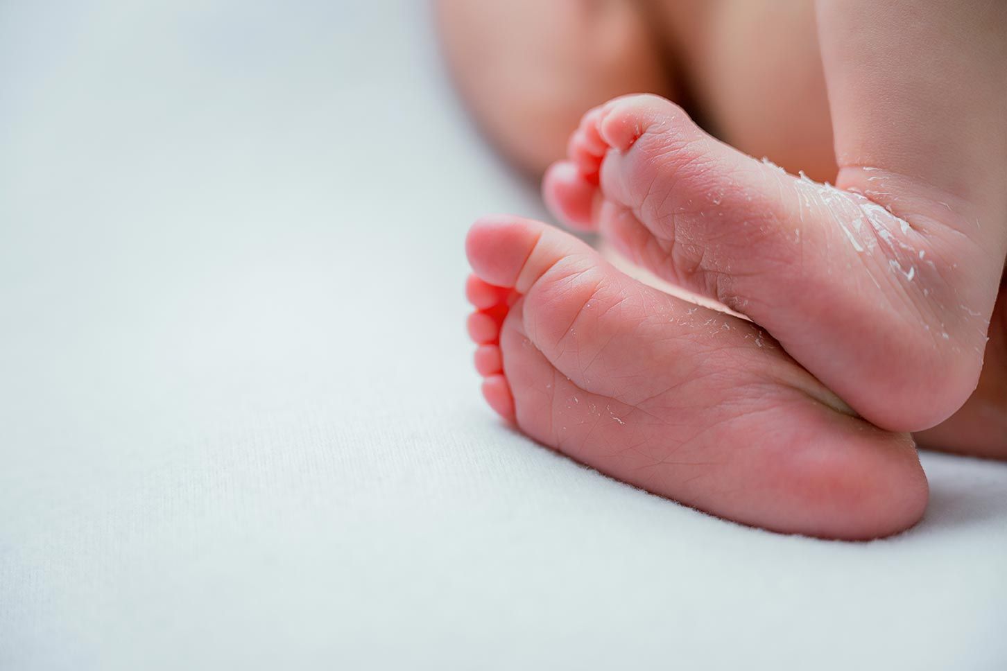 Close-up of tiny newborn baby feet with peeling skin on white background.