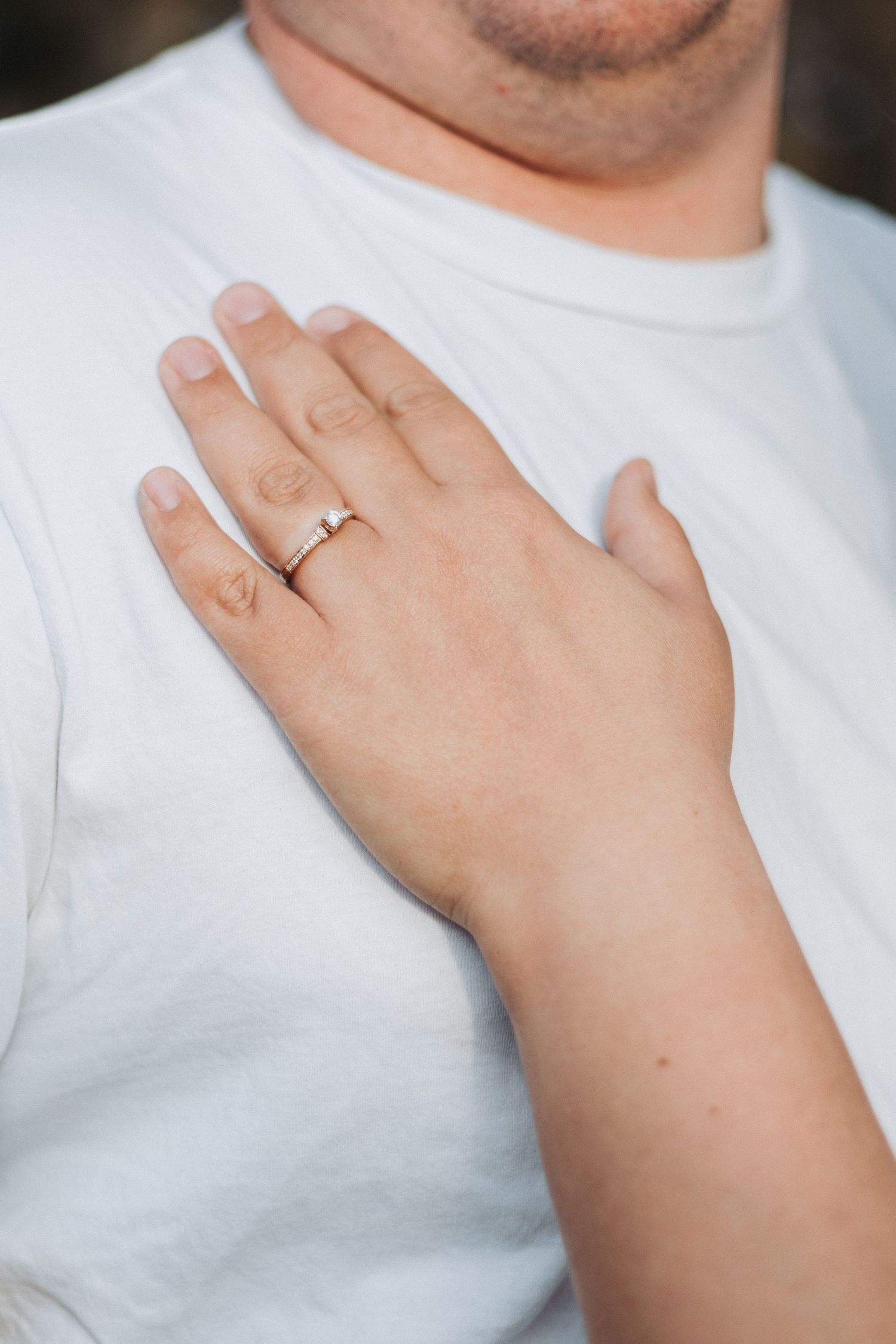A close-up shot of a gold wedding band on a hand against a white shirt.