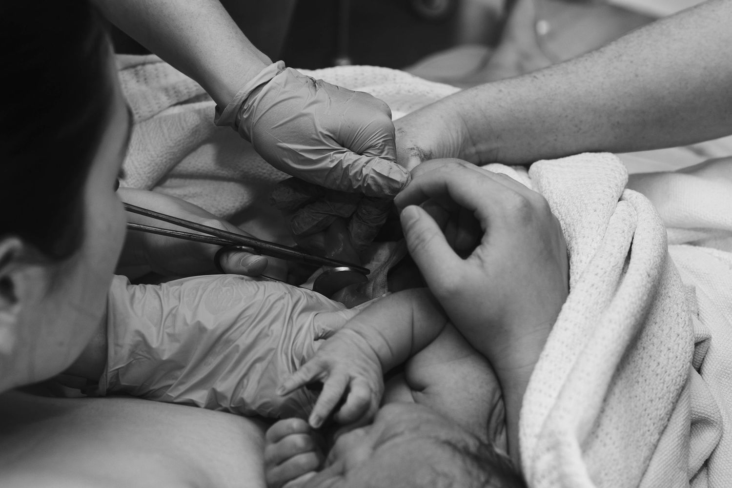 umbilical cord cut birth photography