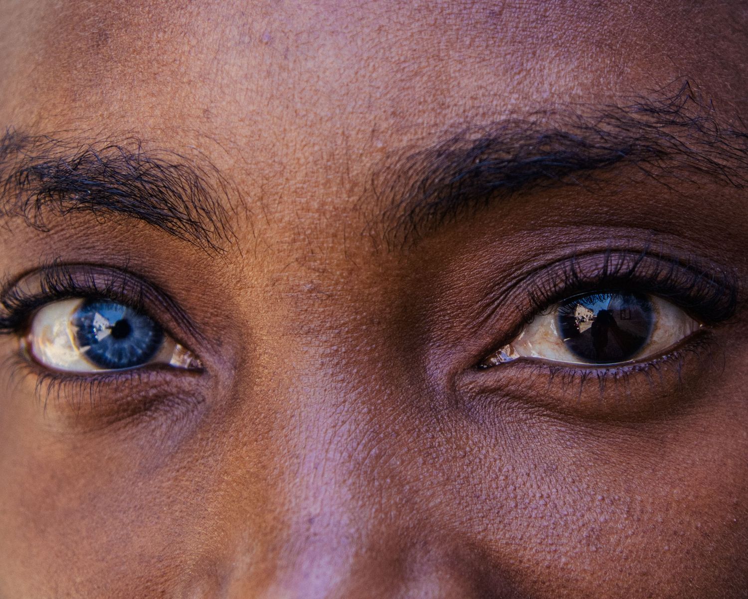 Two coloured eyes
