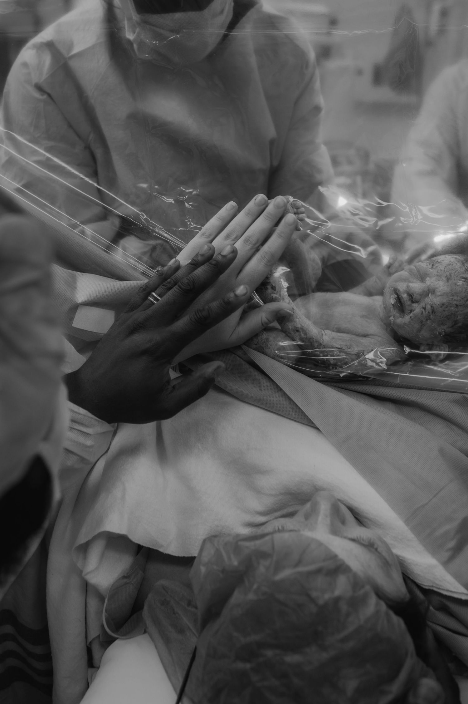 Close-up black and white image of surgical hands performing a medical procedure with surgical instruments.