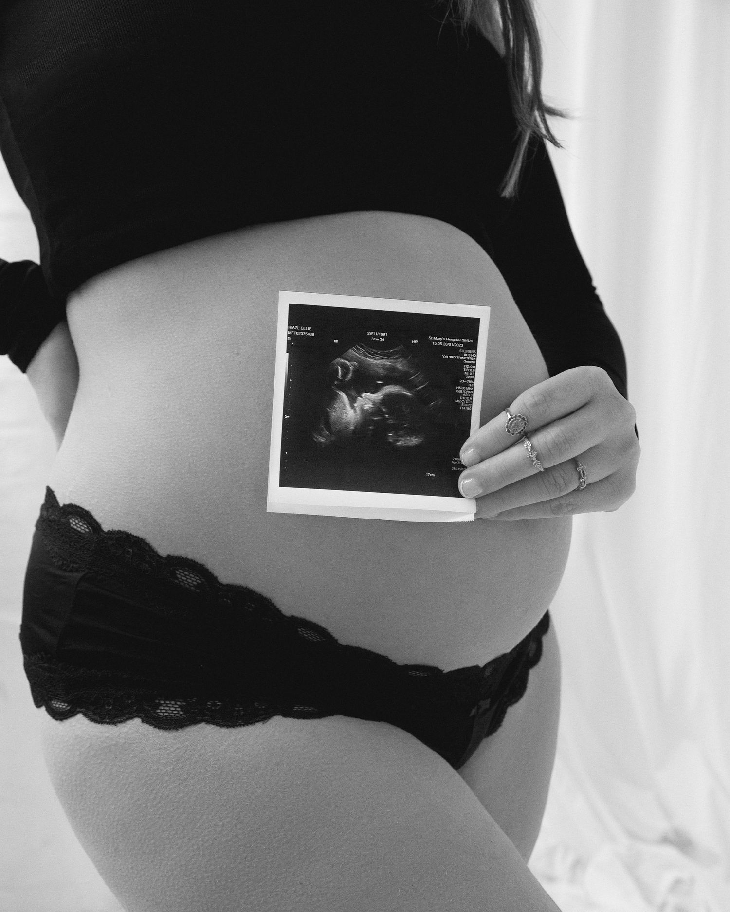 A series of black and white ultrasound photos displayed on a pregnant woman's belly in progressive stages of pregnancy.