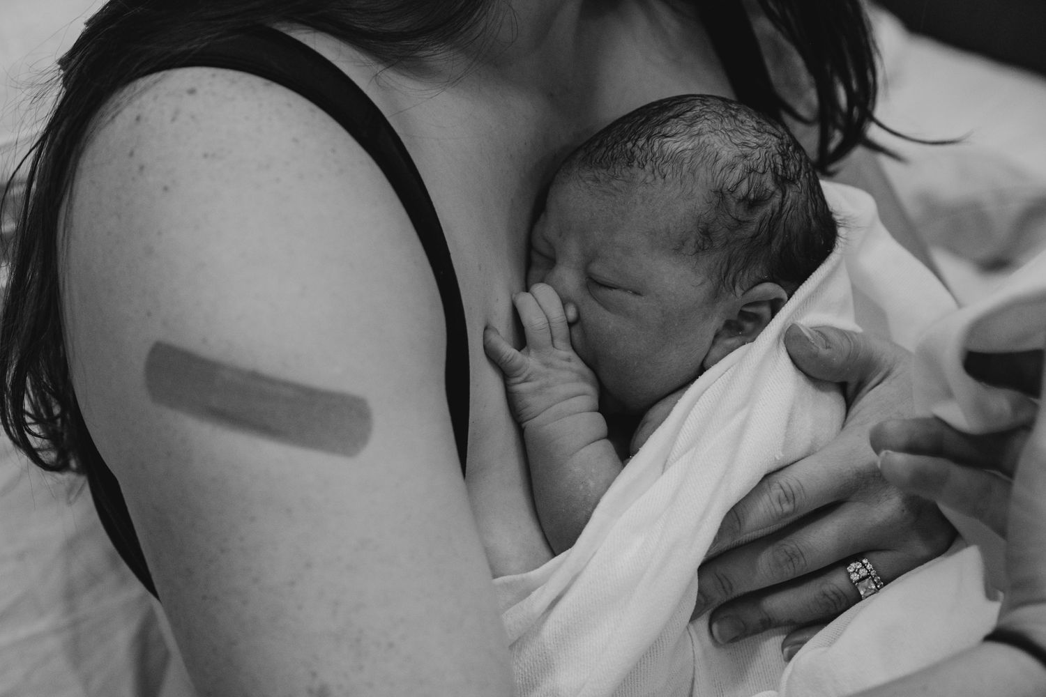 A black and white photo of a mother with a bandage on her arm breastfeeding her newborn baby.