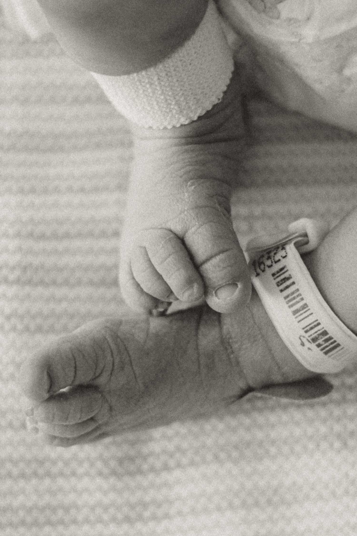Black and white close-up of newborn baby feet with hospital identification bracelet on a striped blanket.