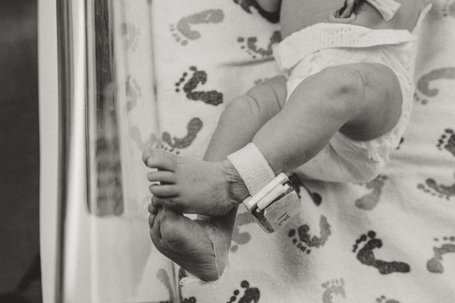 Black and white photo of newborn baby feet with hospital ID bracelet on footprint patterned blanket.