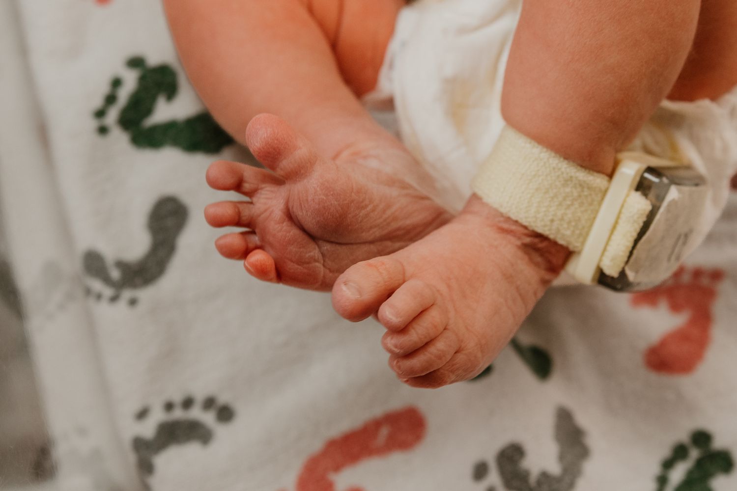 Close-up of newborn baby feet with hospital ID bracelet on a footprint patterned blanket.