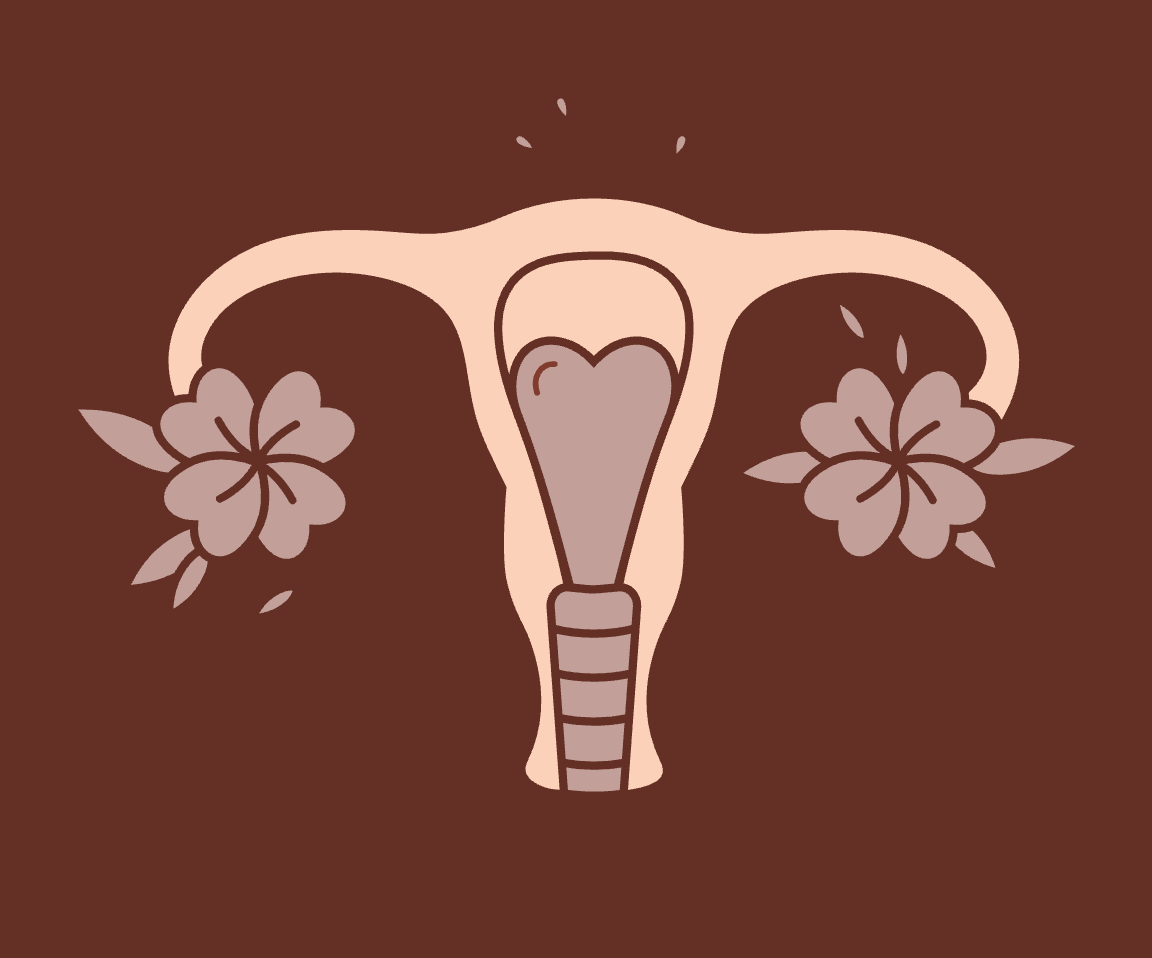 Illustration - Douleur pelvienne - Endométriose - SPOM