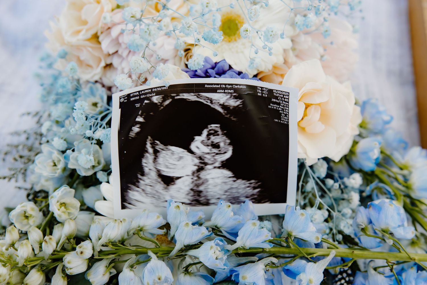 Ultrasound photo nestled among white roses and blue delphinium flowers in a pregnancy announcement.