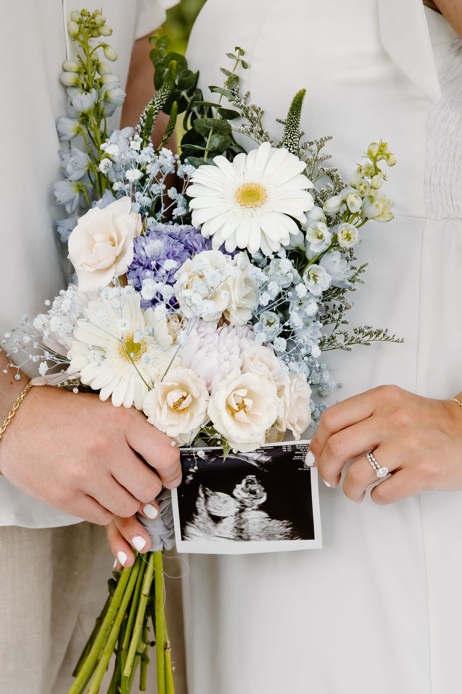 Close-up of wedding bouquet with white gerbera daisies and ultrasound photo nestled among flowers.