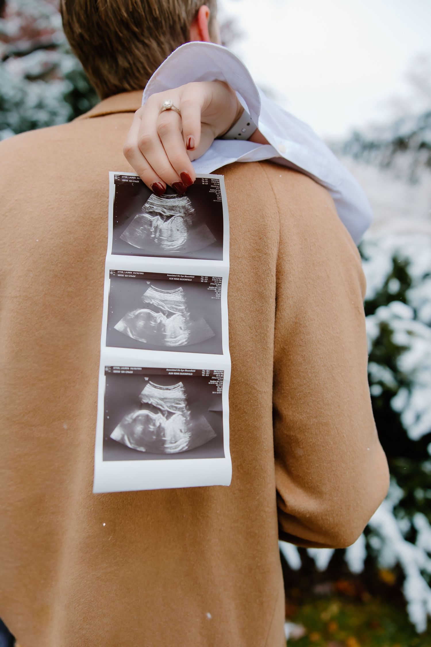 Ultrasound photos being held against a tan coat in an outdoor winter setting.