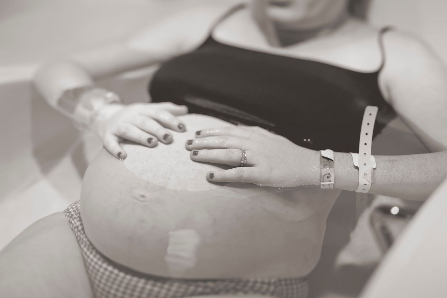 Black and white close-up of hands resting on pregnant belly with hospital bracelet visible.