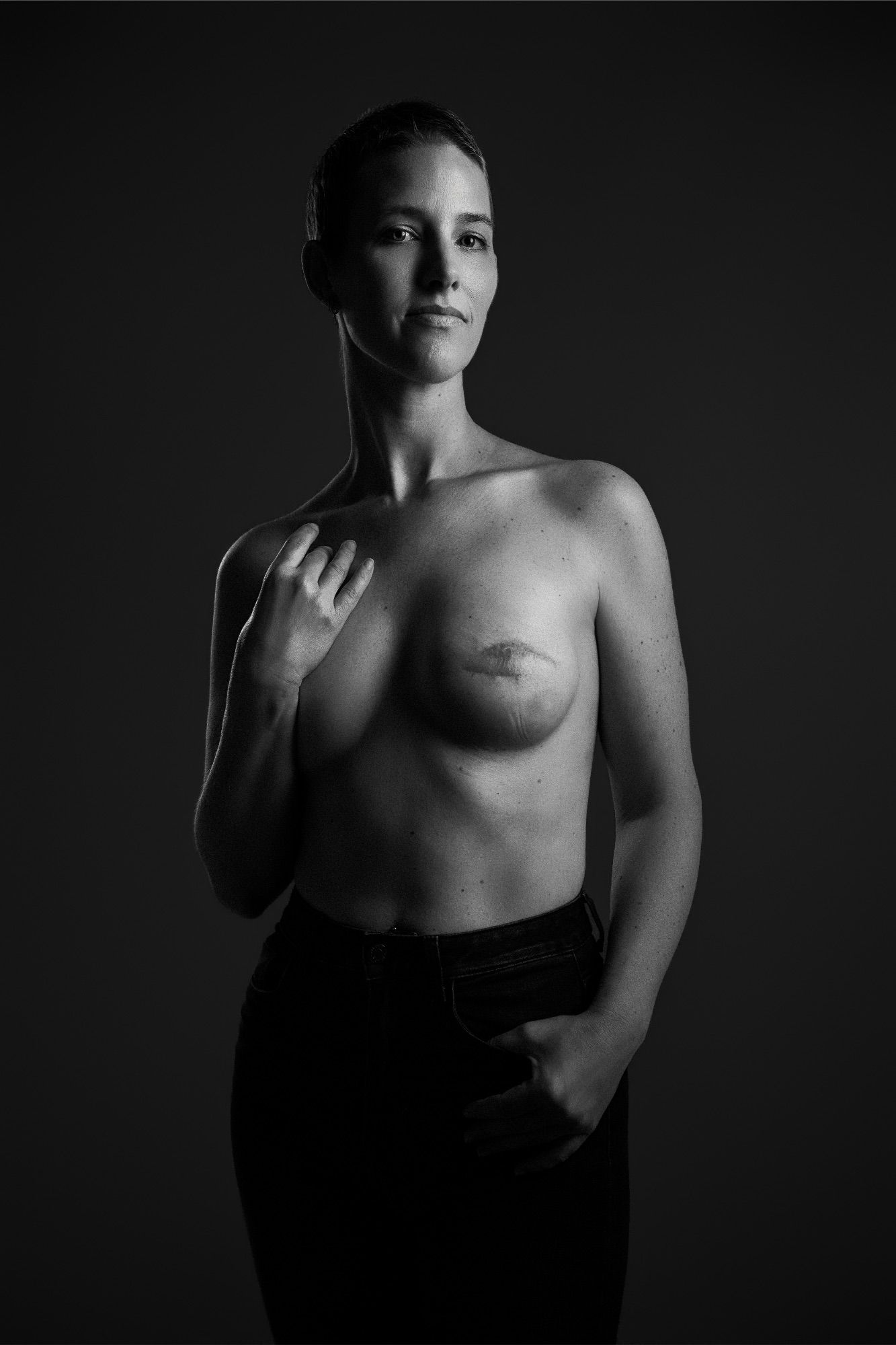 Black and white portrait of a woman showing mastectomy scar, powerful breast cancer survivor photography.