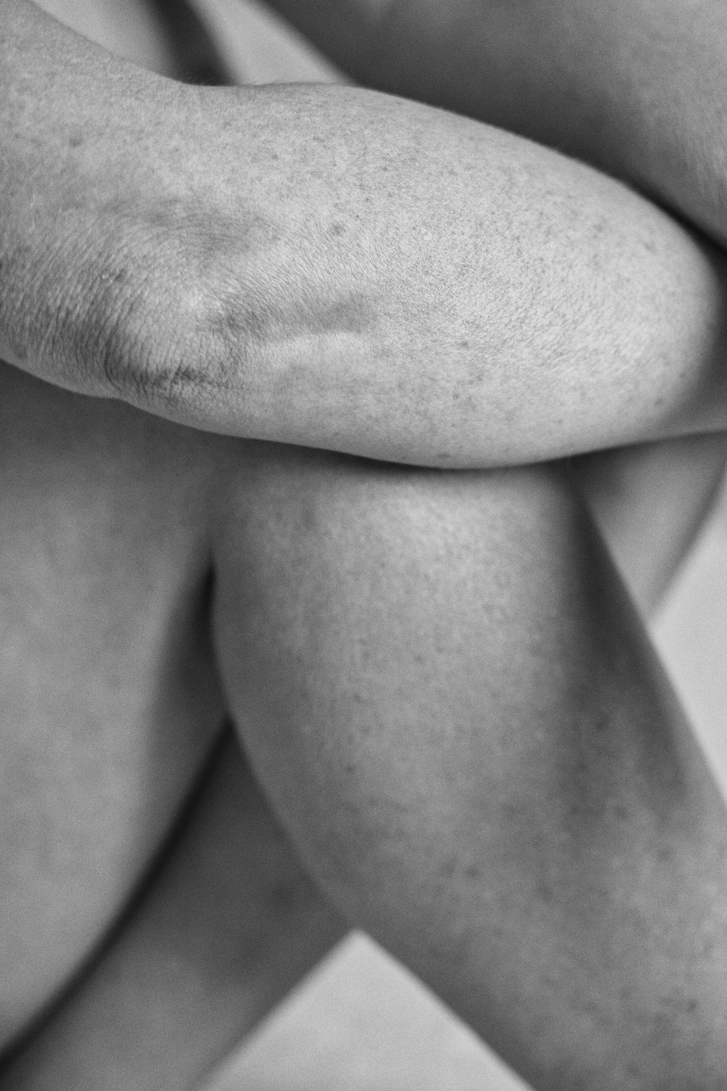 Black and white close-up photo of human knees and legs crossed together, showing skin texture and natural body form.