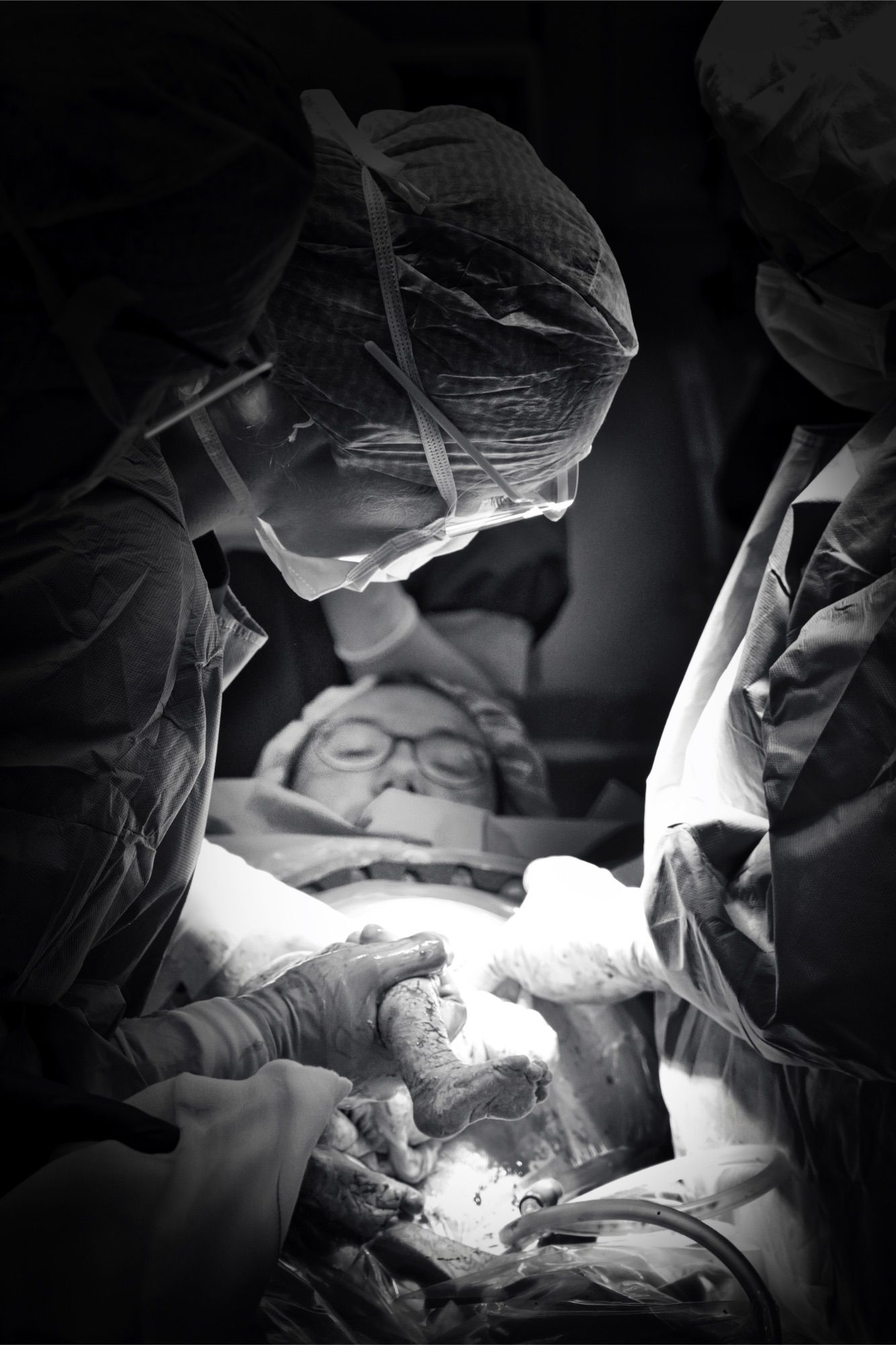 Surgical team delivering baby during cesarean section while mother watches in OR.