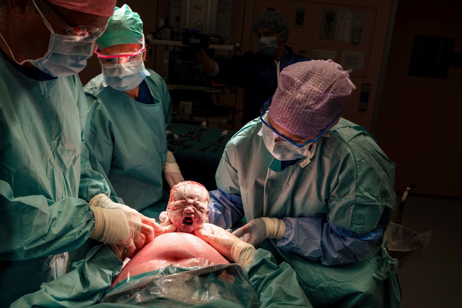 Surgeons in green scrubs delivering crying newborn during cesarean section procedure. Birth photography by Constanze Ariane