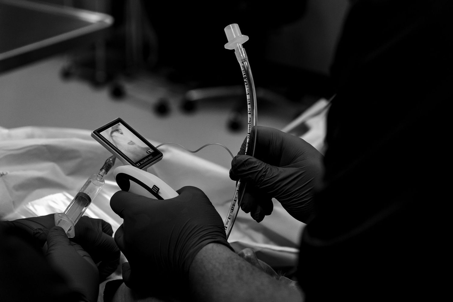 Gloved hands holding tube and laryngoscope next to a patient, photo during a surgical procedure. Medical Documentary by Constanze Ariane
