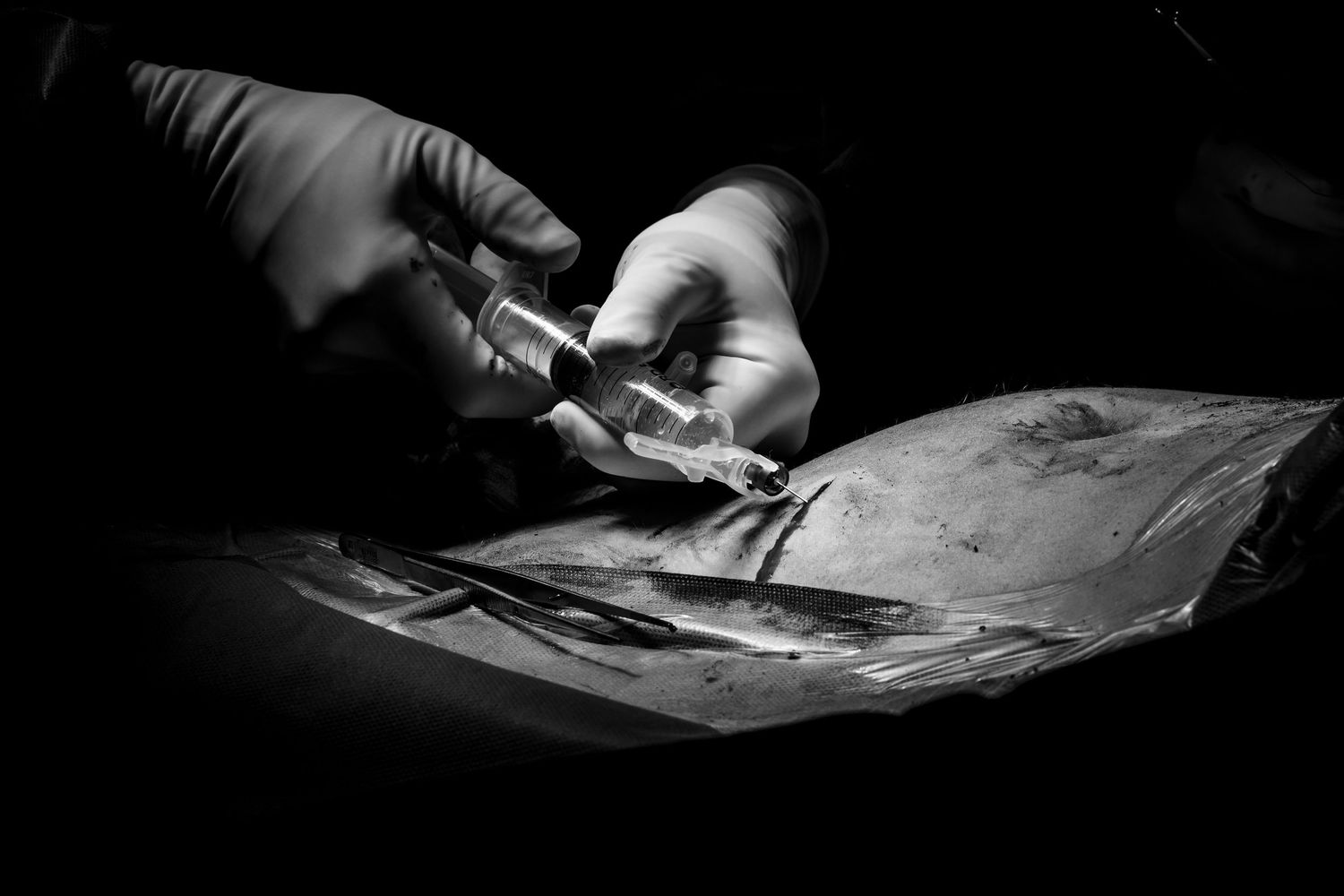 Close-up black and white image of gloved surgeon hands handling surgical instruments. Medical Documentary photography by Constanze Ariane.