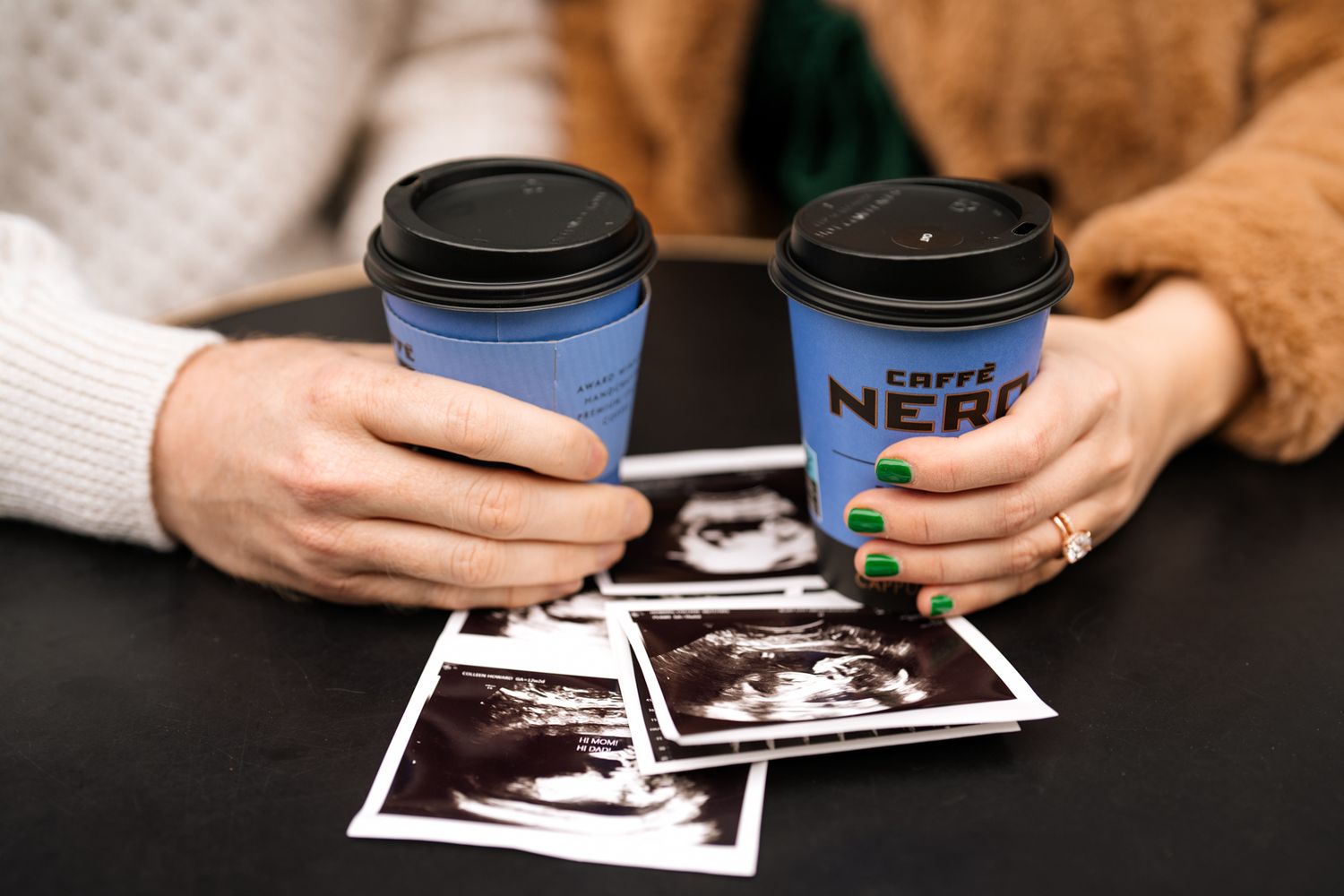 A person's hands holding two coffee cups and ultrasound photos on a dark surface.