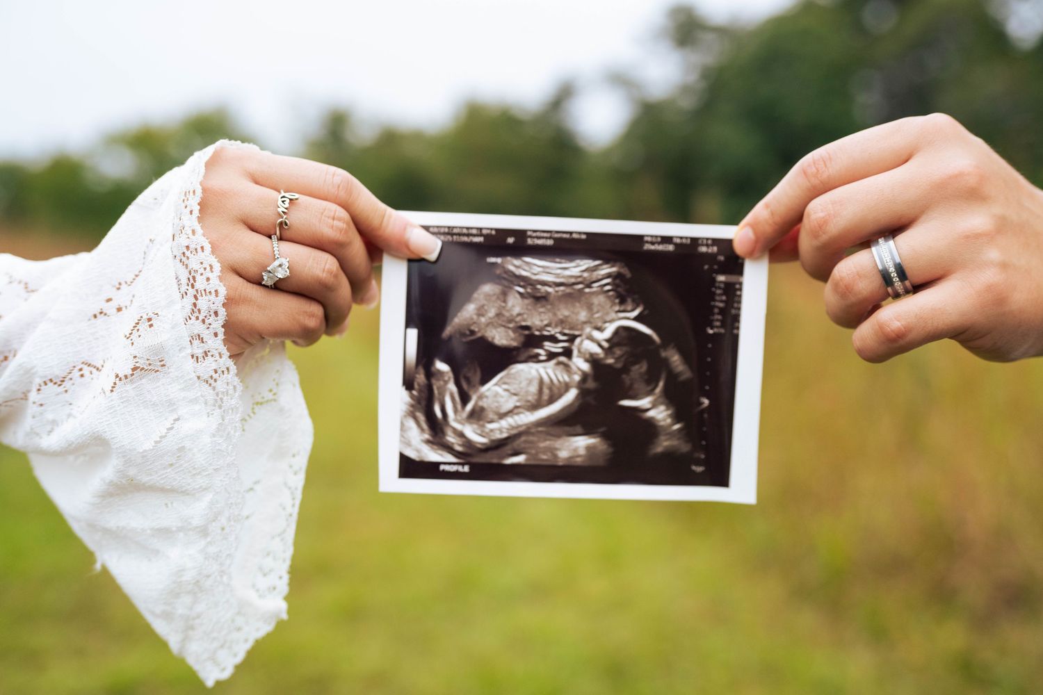 Holding their baby’s sonogram together in celebration of their growing family.