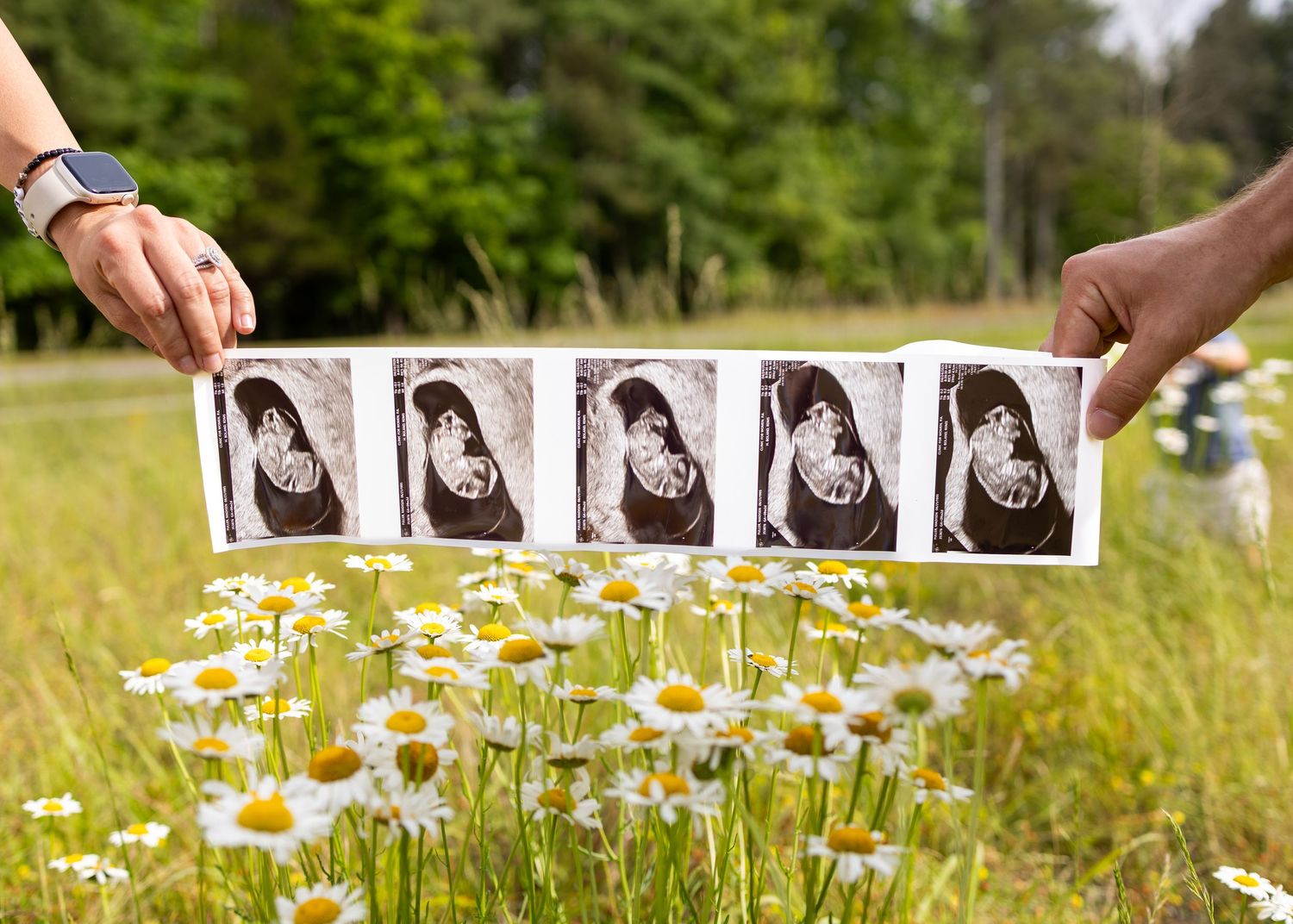 Two hands hold a strip of black and white pregnancy ultrasound photos over a field of white daisies outdoors.