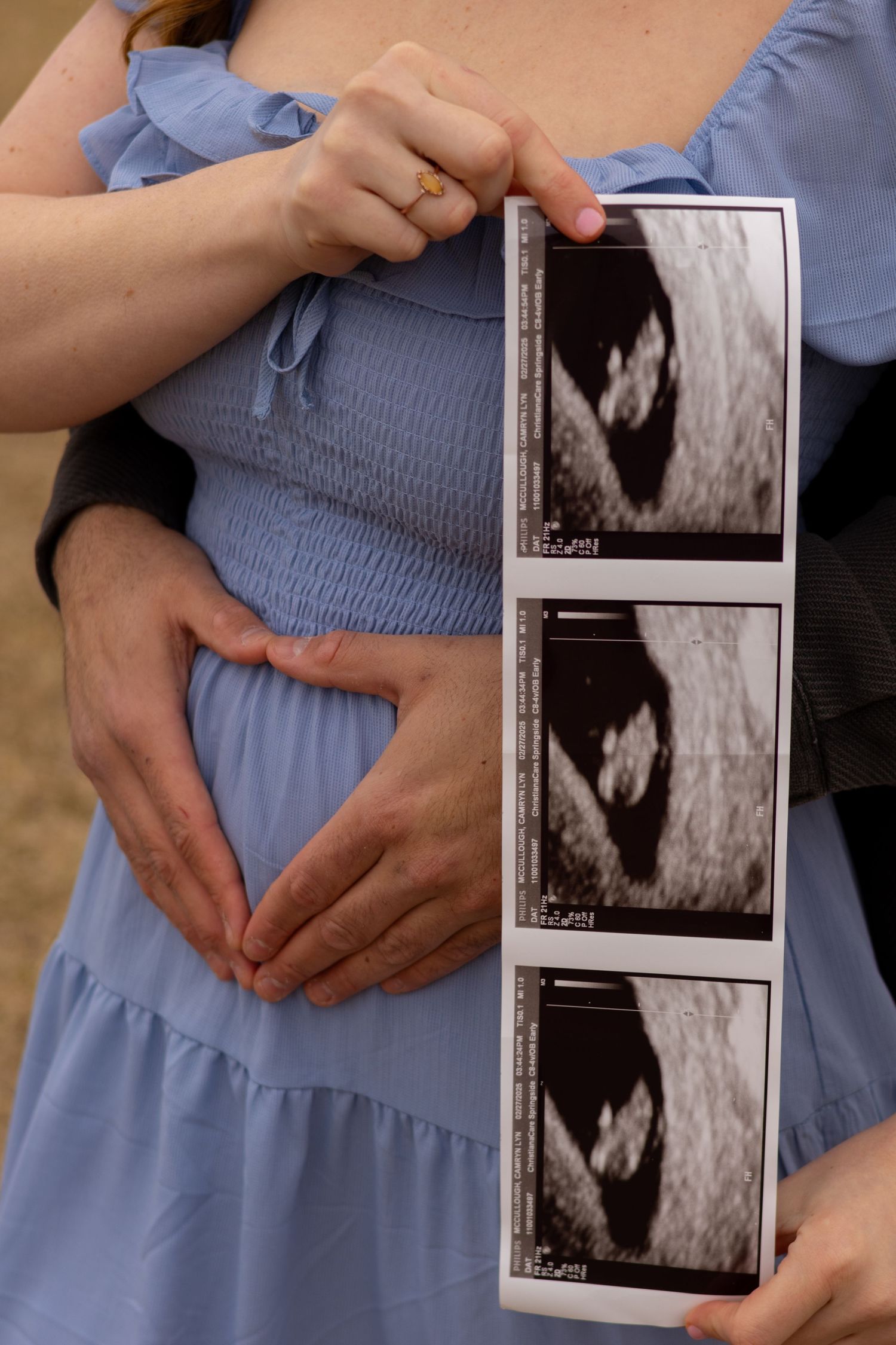 Hands hold ultrasound images while wearing a blue dress during a pregnancy announcement in Elkton, Maryland.