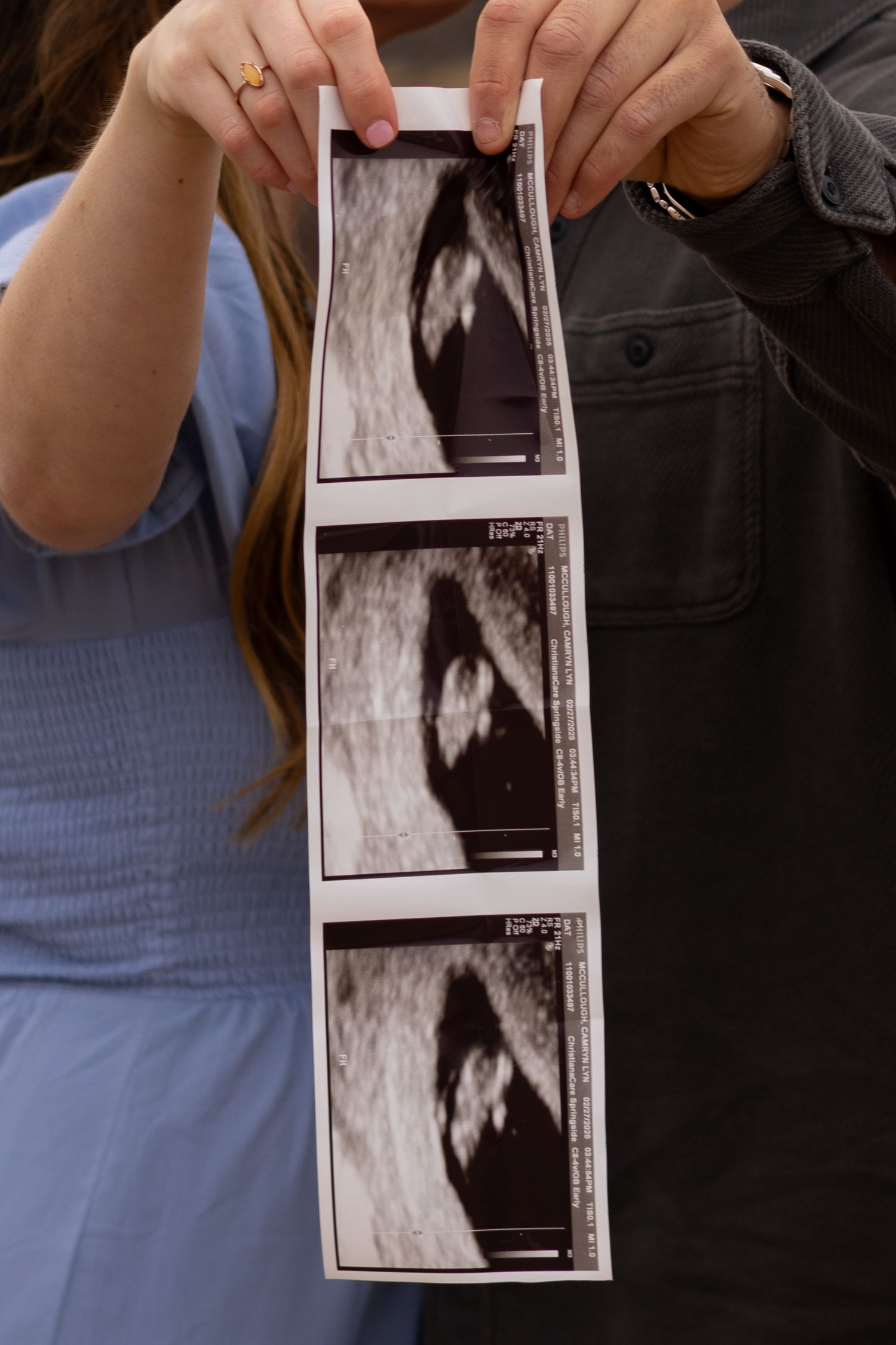 Close-up of hands holding ultrasound photos against a blue dress in Elkton, Maryland.