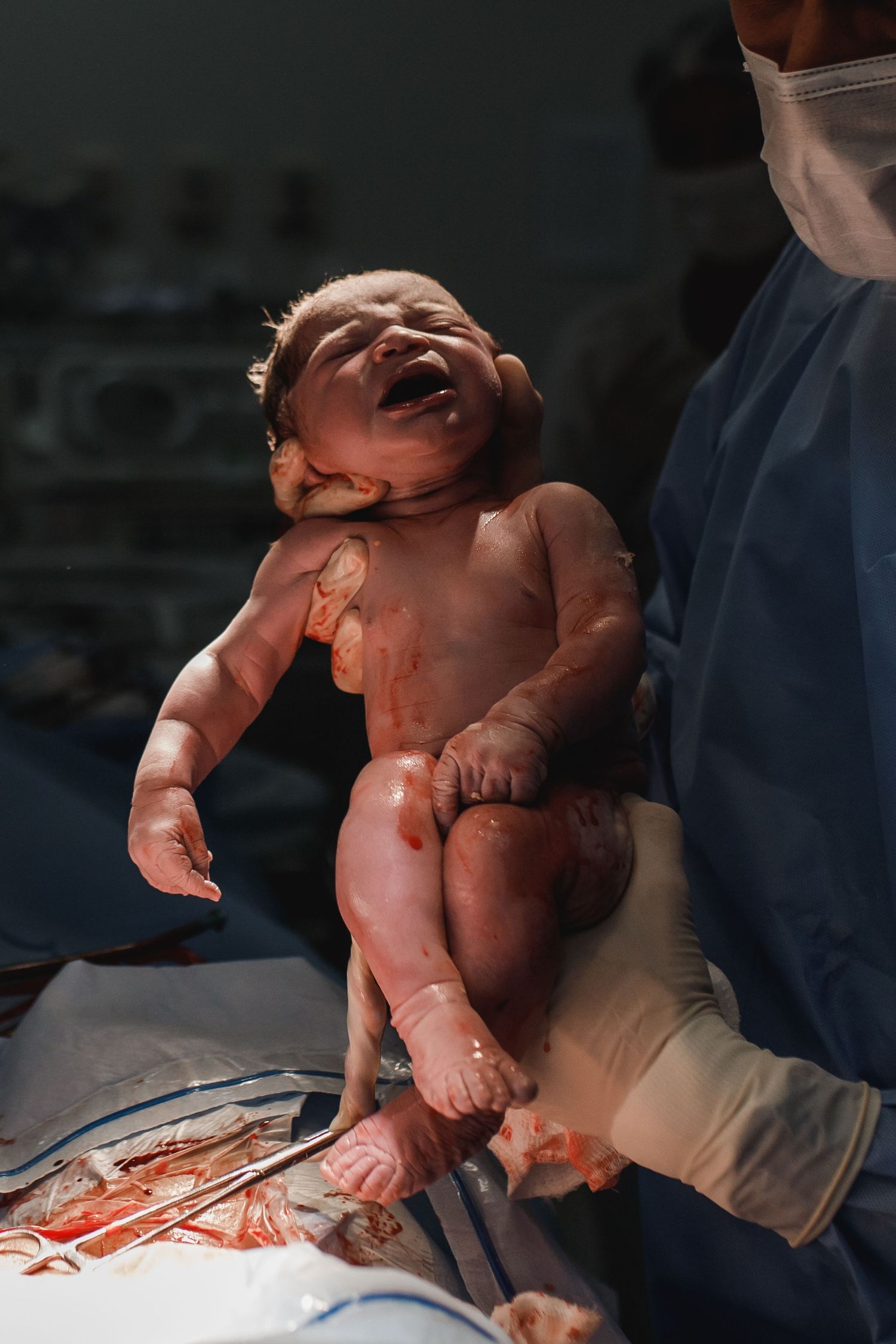 A newborn baby being examined on a medical table.