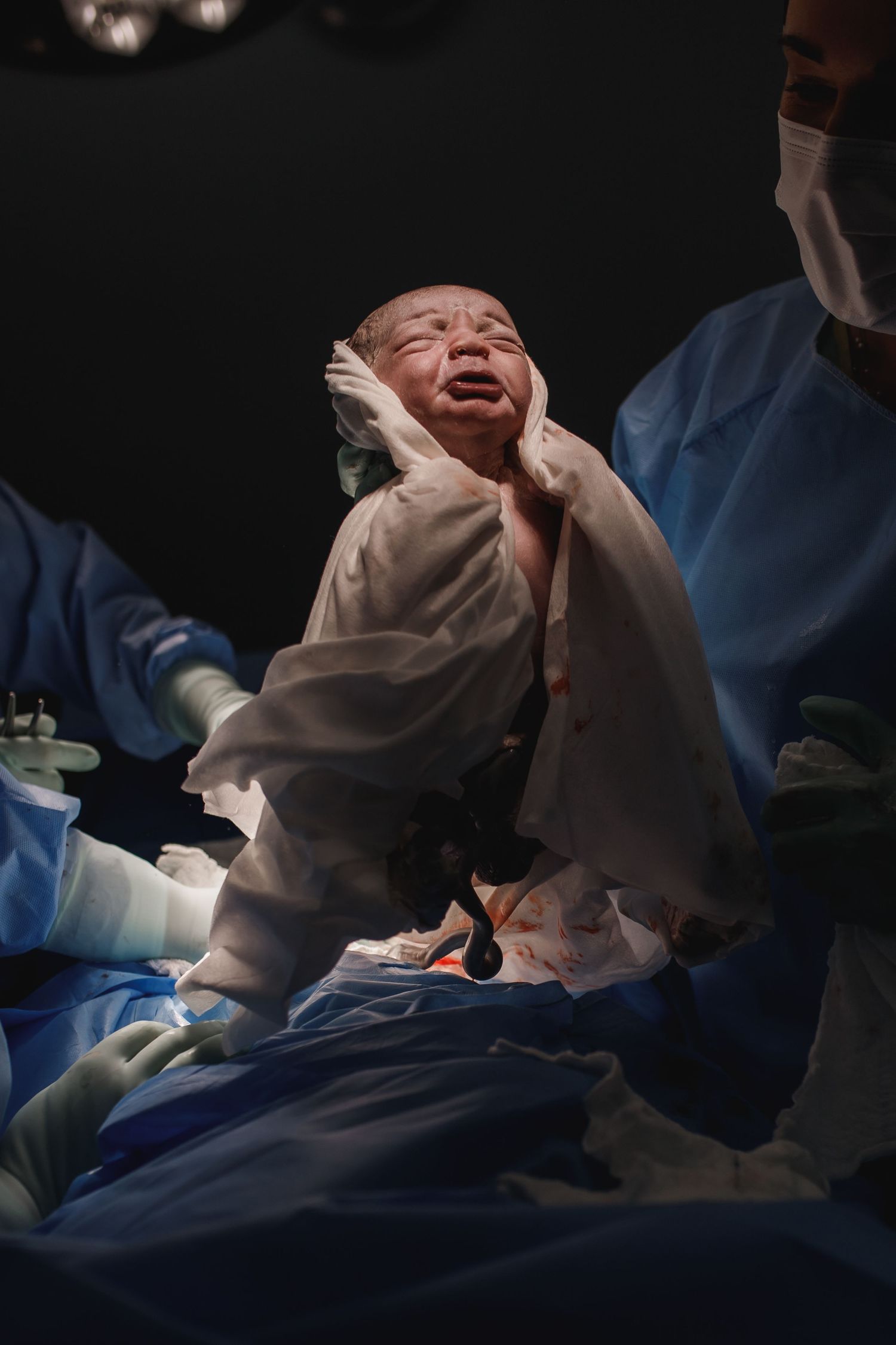 A newborn baby crying during first moments after birth in a hospital delivery room.