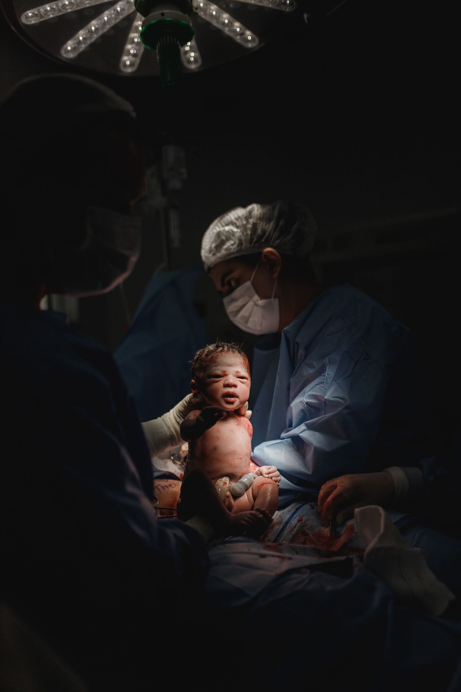 Surgical team working under bright operating room lights during a medical procedure.
