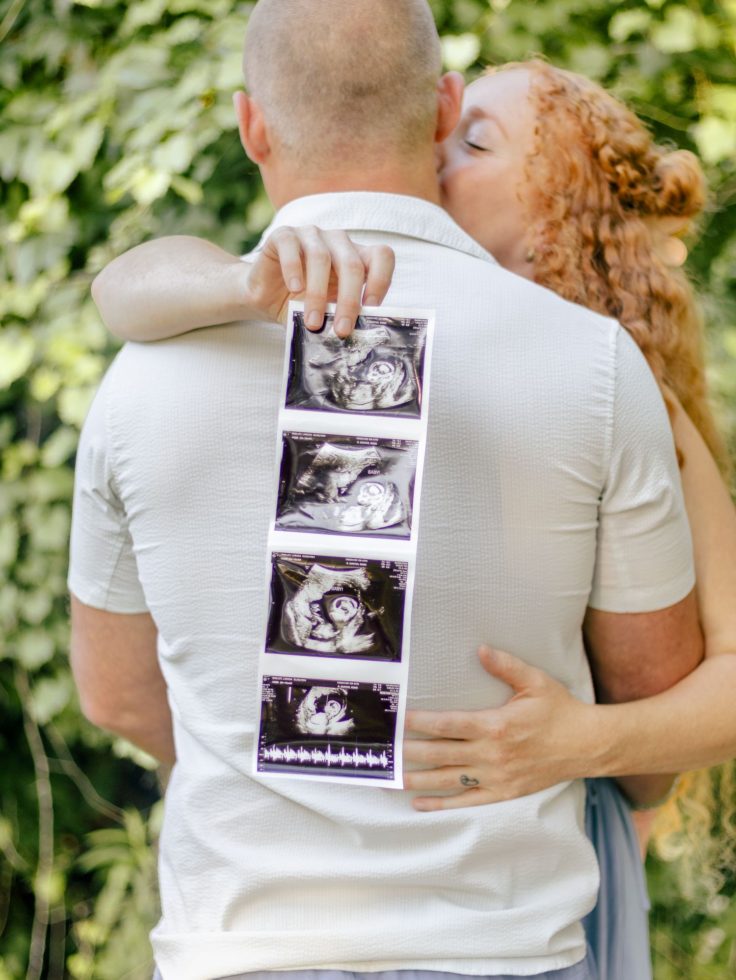 Couple embracing outdoors as the woman kisses the man's cheek while holding a strip of four ultrasound photos against his back.