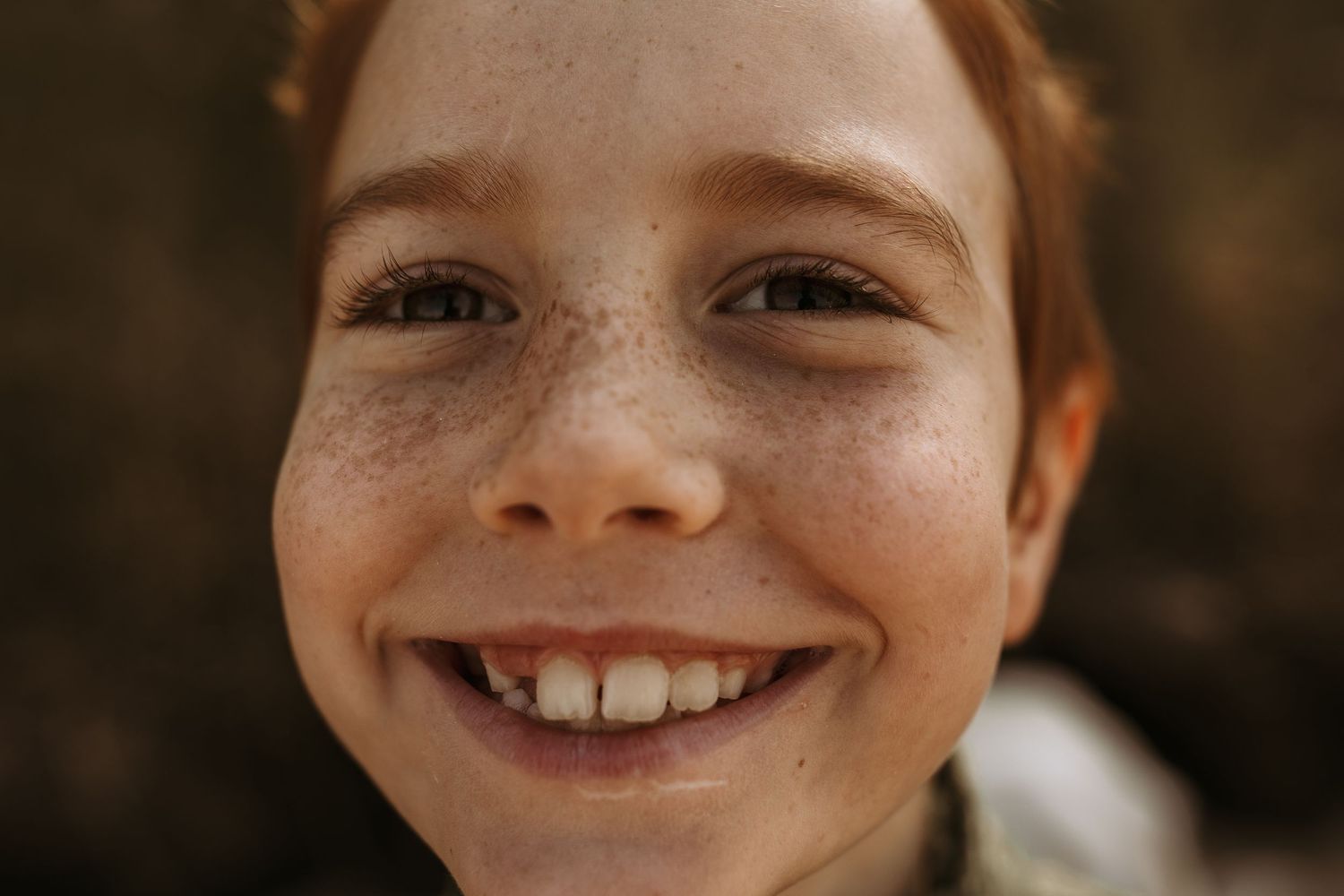 A smiling red-haired freckled child looks directly at the camera with a joyful expression.