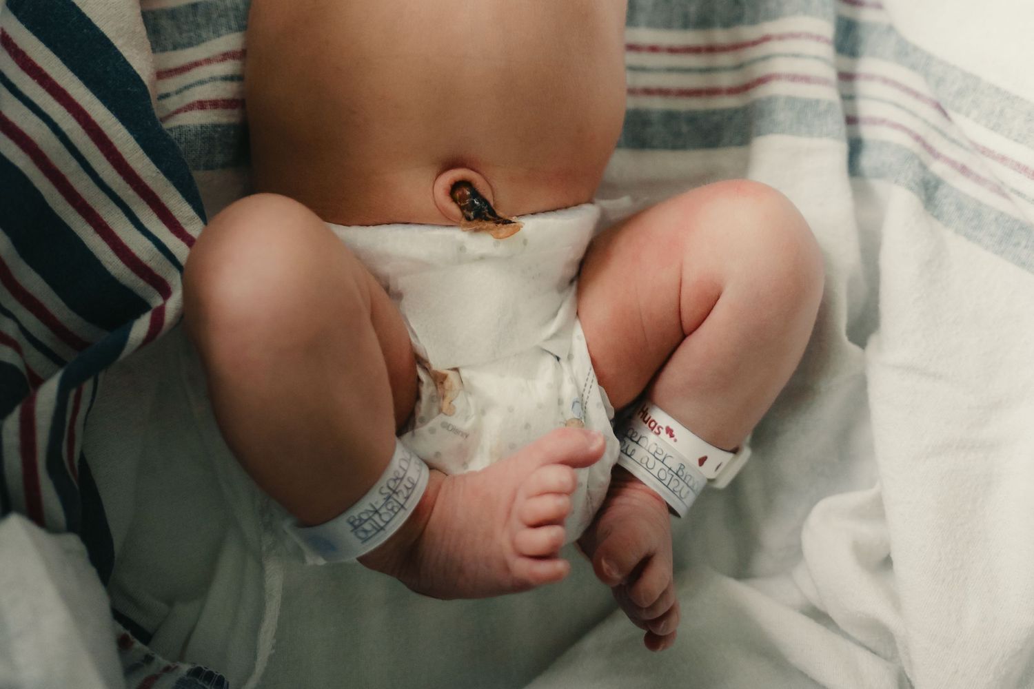 Close-up of a newborn baby in a diaper with hospital ID bands on their ankles, lying on a striped blanket.