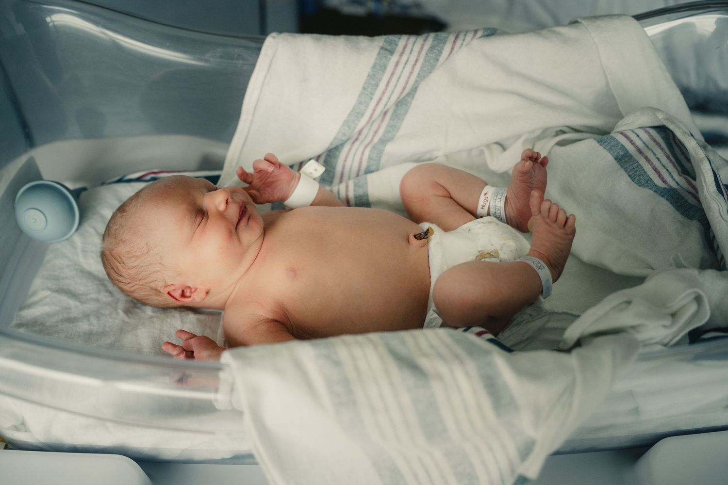 Newborn baby resting in a hospital bassinet, wearing a diaper and medical bracelet in a neonatal care unit.