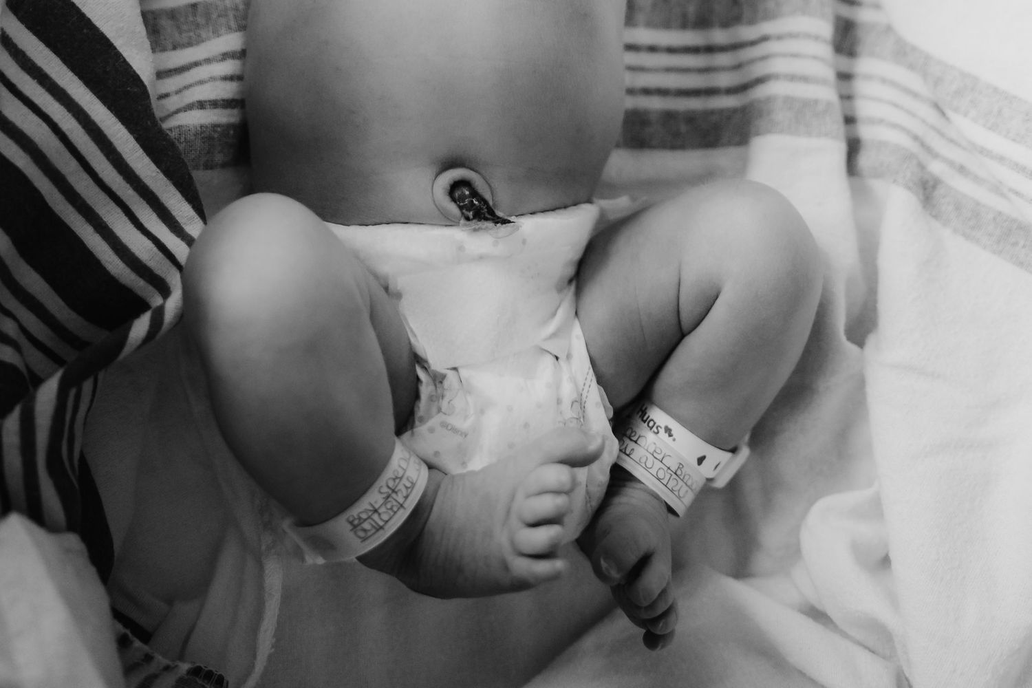 Black and white photo of a newborn baby lying in a diaper with hospital ID bracelets.