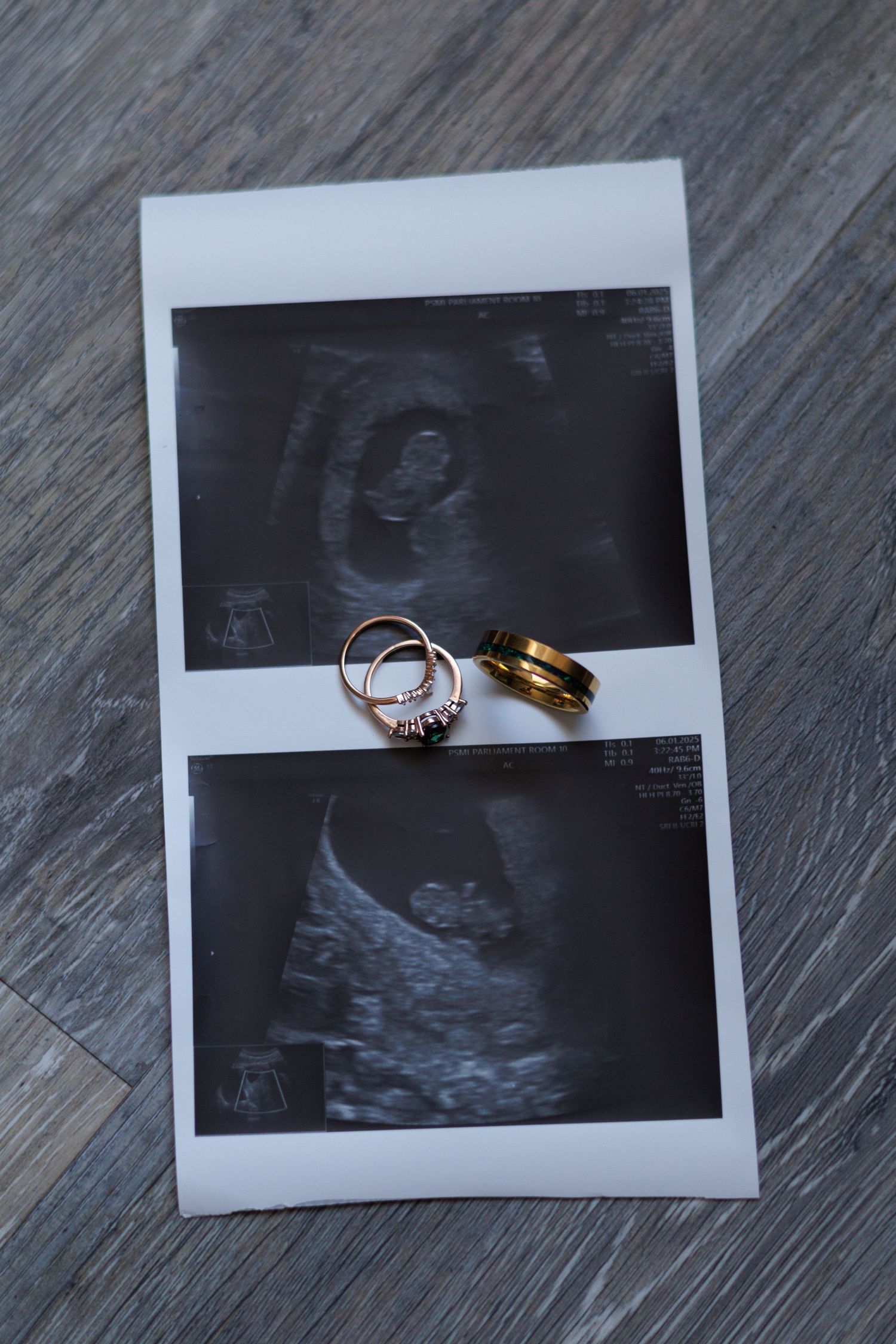 Sonogram images arranged with wedding bands on wooden background.