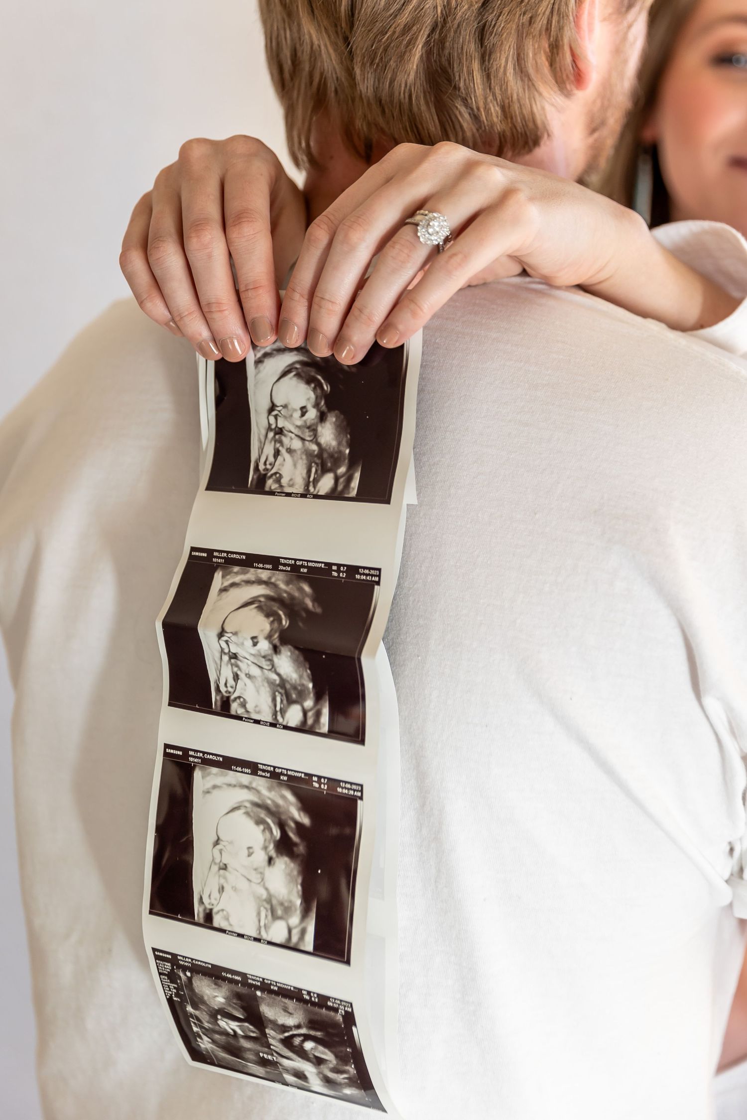A series of ultrasound photos being held and displayed against a white background.