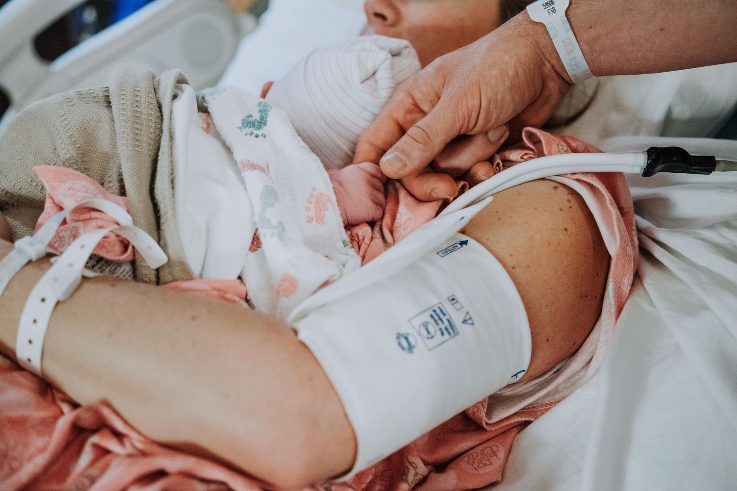 Close-up of newborn baby with hospital bracelet resting on mother's arm after birth.