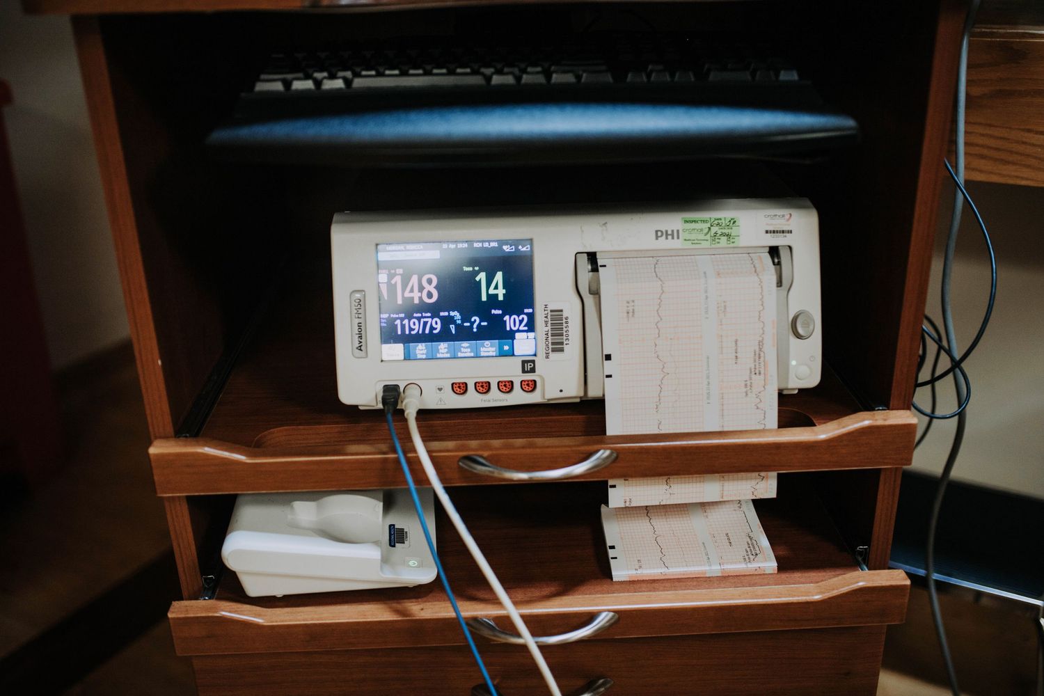 Hospital fetal heart rate monitor displaying readings on a wooden bedside cabinet.