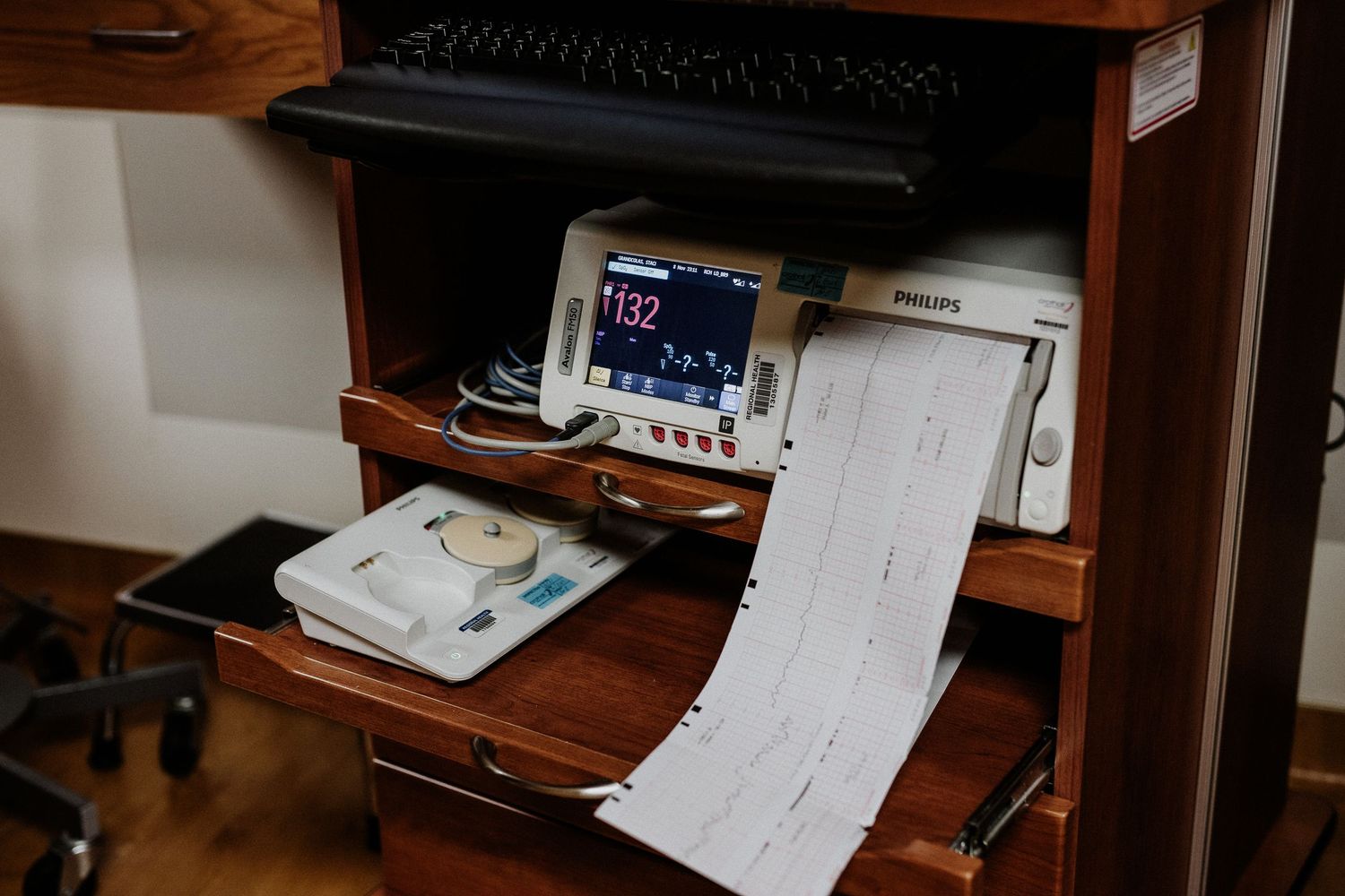 A Philips fetal heart rate monitor displays readings next to printed medical charts in a hospital room.