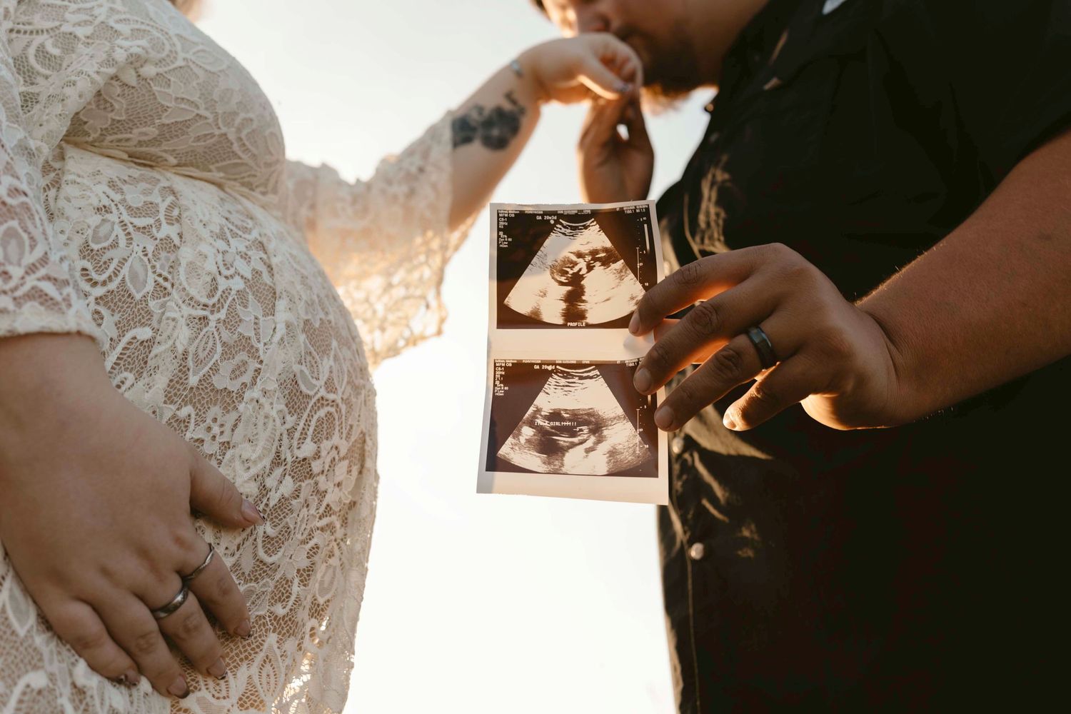 A collection of wedding detail photos showing rings, hands, lace dress details, and an ultrasound image arranged in a row.