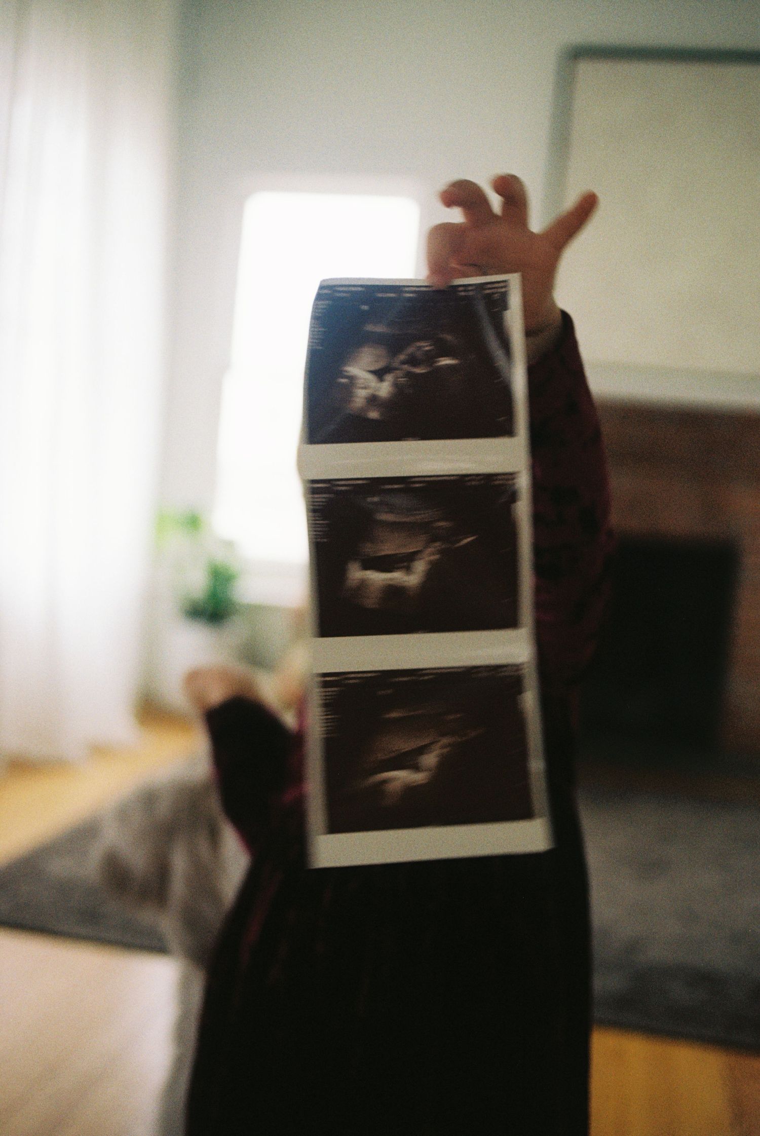 A series of hands holding up ultrasound photos against a light background.