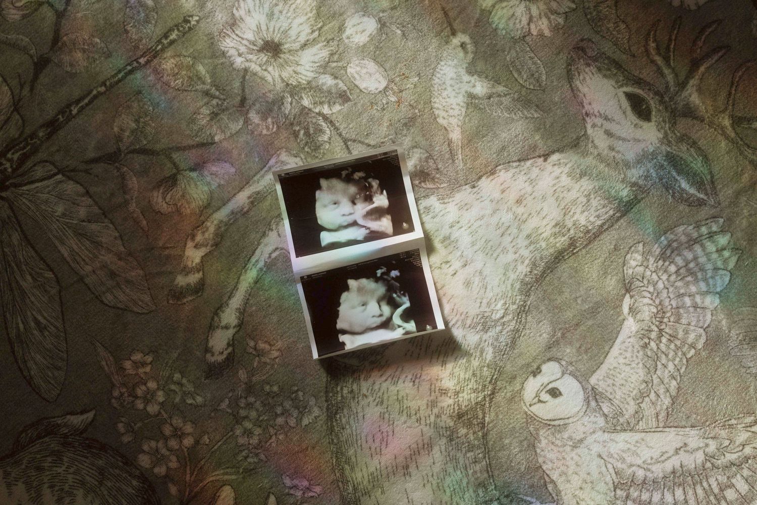 An overshot view of an ultrasound picture laying on the floor