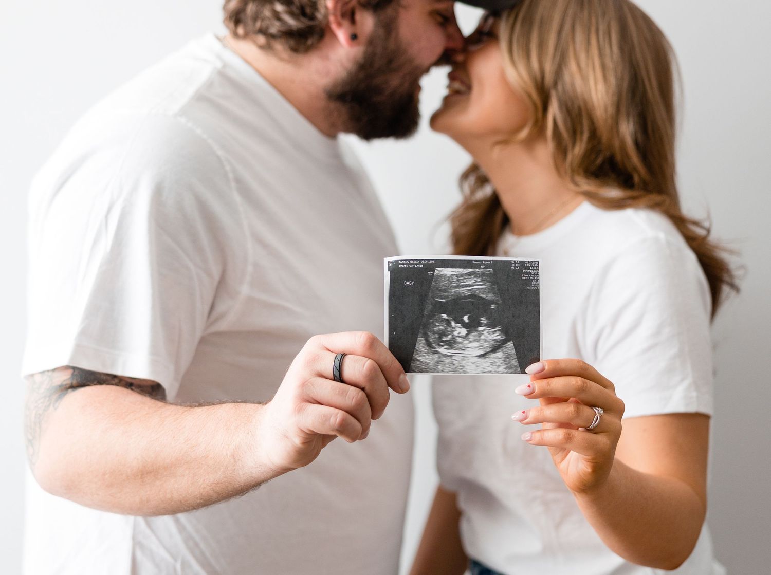 Couple kissing while holding ultrasound photo announcing their pregnancy.