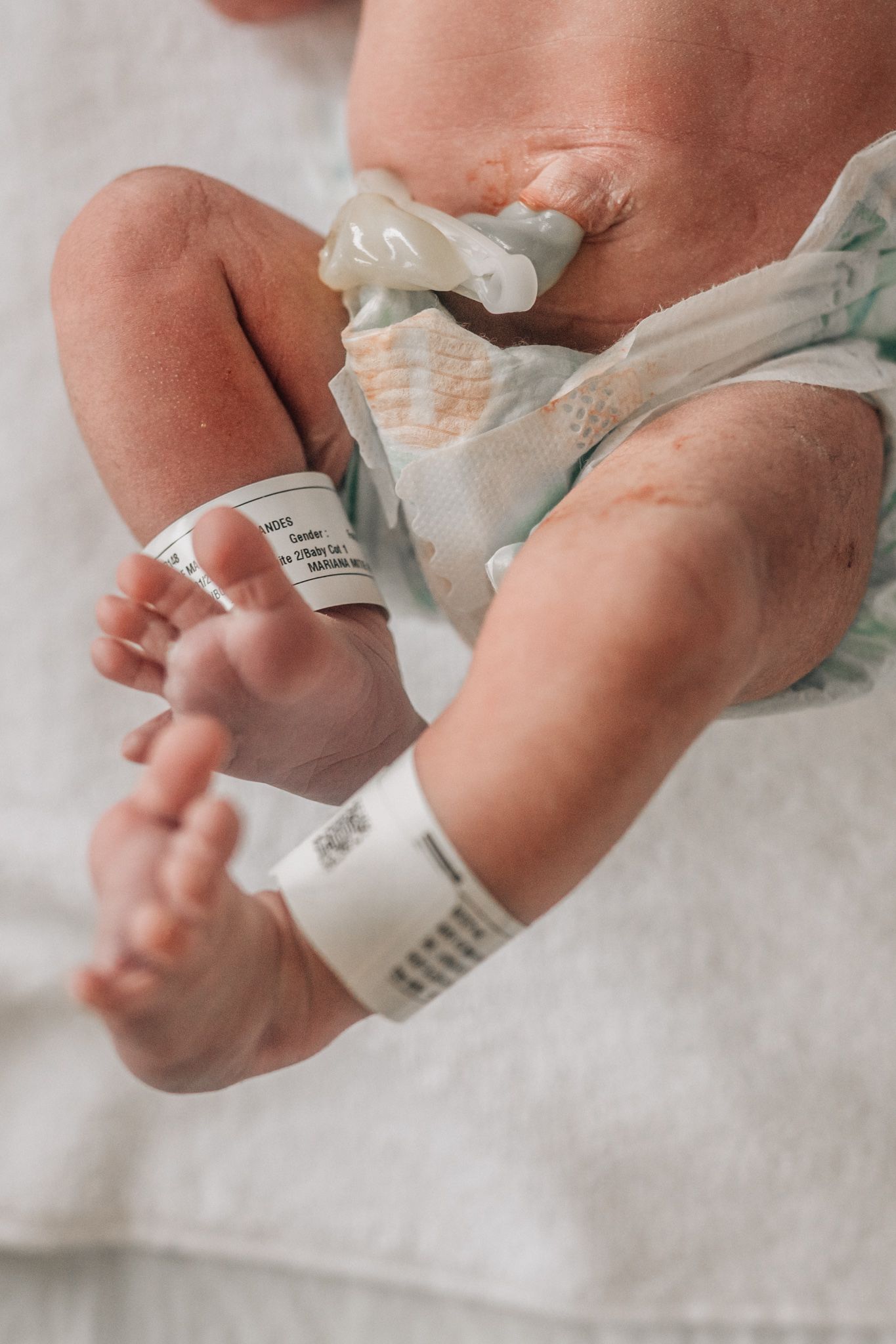 photos of a newborn baby showing legs and umbilical cord