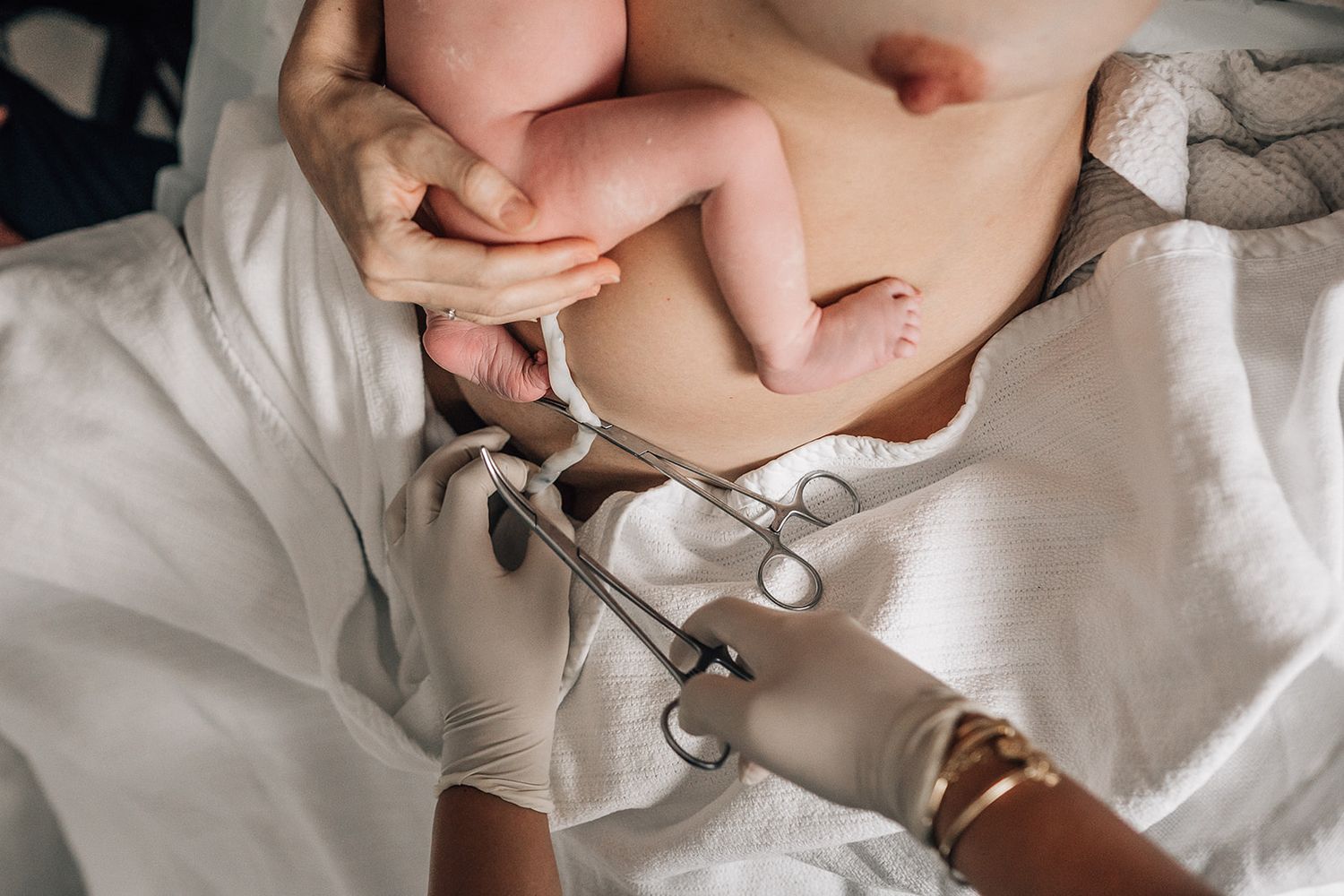 cutting an umbilical cord captured by a Dubai birth photoshoot