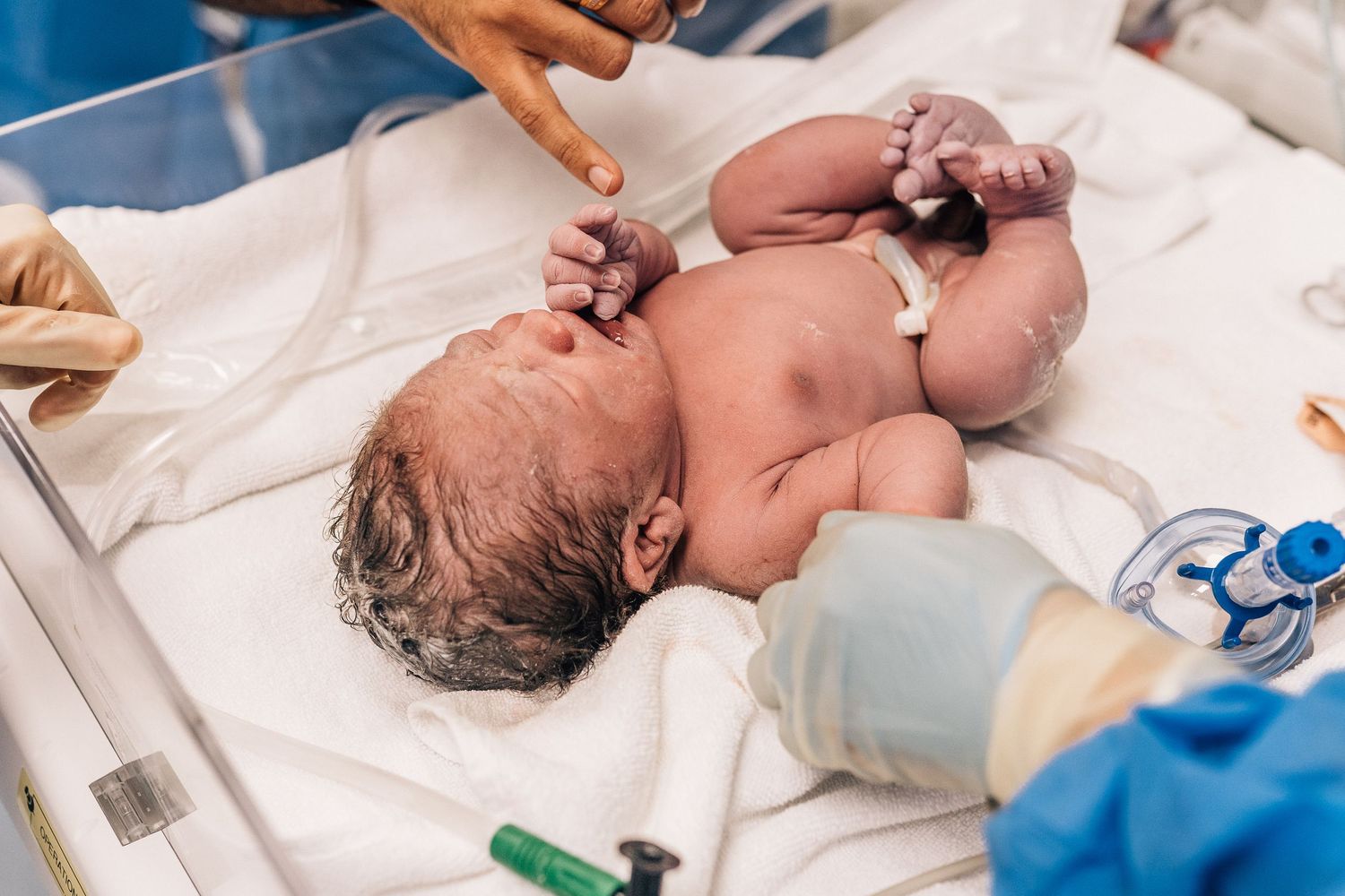 newborn baby being checked after cesarean birth in dubai
