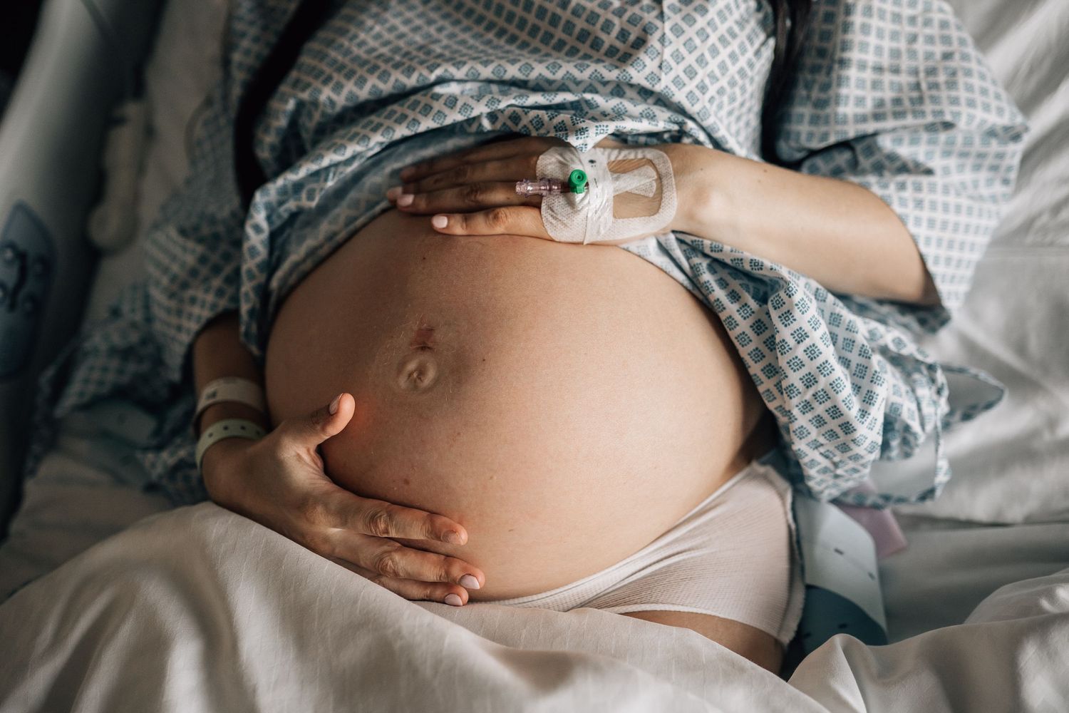 cesarean section birth captured by a Dubai birth photographer