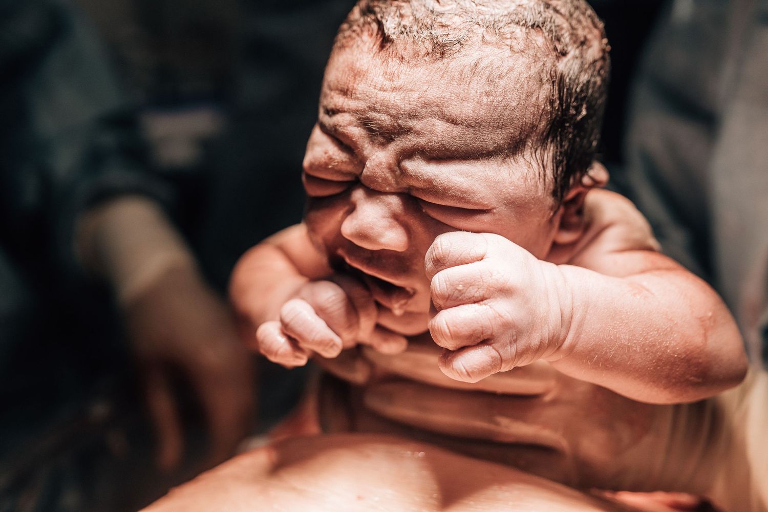baby being born via cesarean birth in dubai hospital captured by a birth photographer