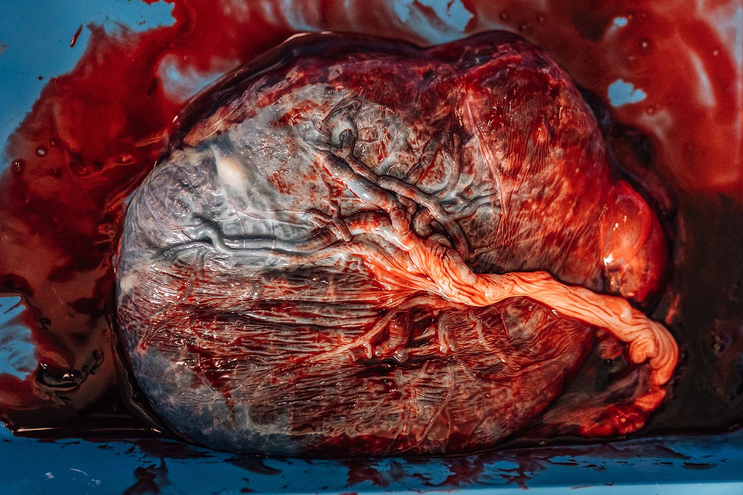 placenta
