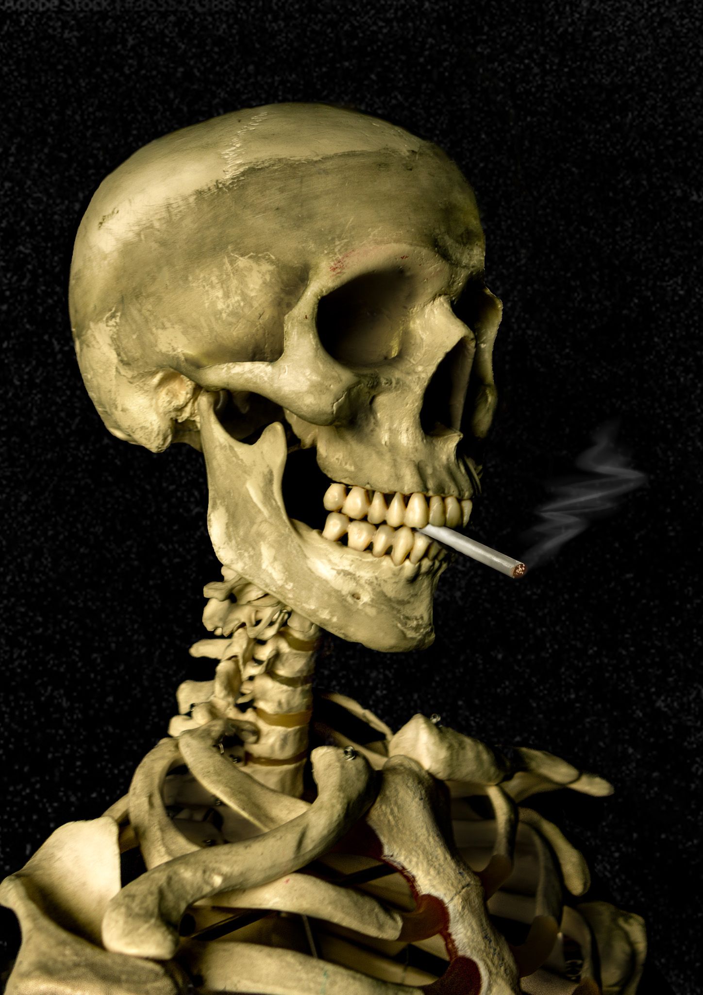 bones